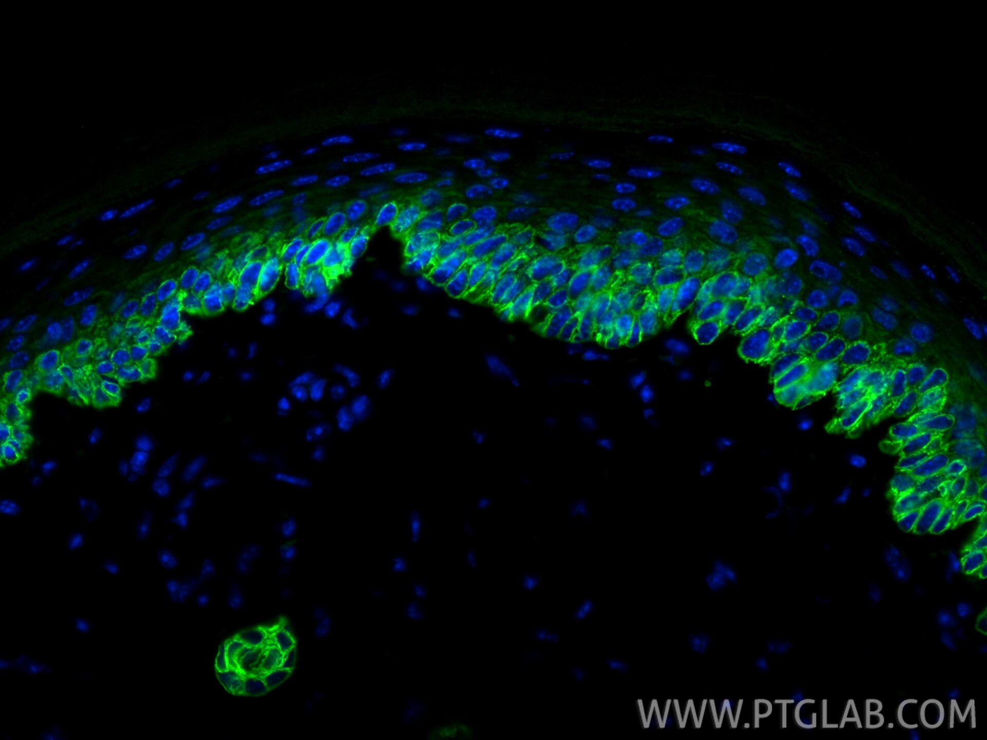 Immunofluorescence (IF) / fluorescent staining of mouse skin tissue using Cytokeratin 14 Recombinant antibody (82824-1-RR)