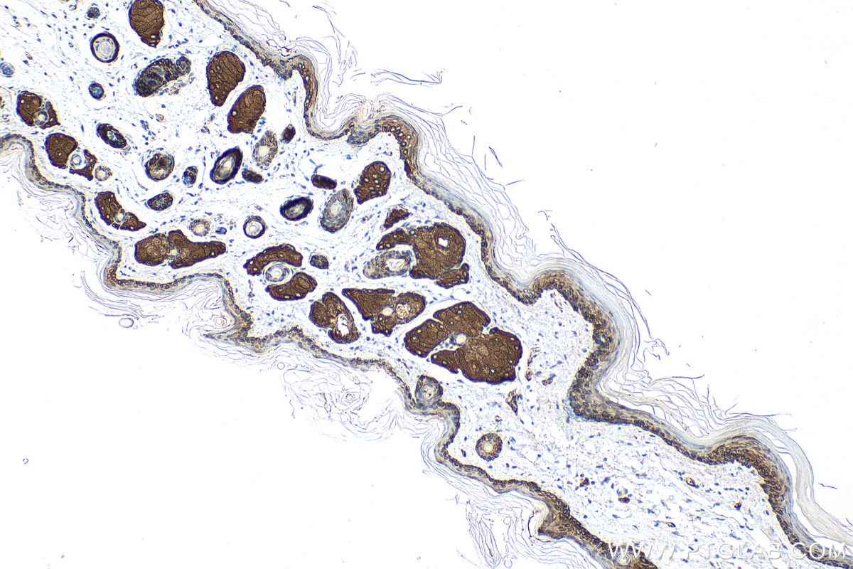 Immunohistochemistry (IHC) staining of mouse skin tissue using Cytokeratin 14 Recombinant antibody (82824-1-RR)