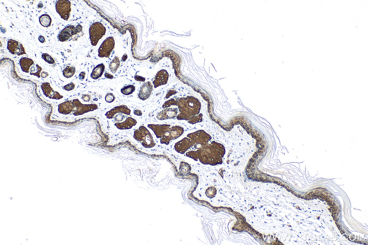 Cytokeratin 14