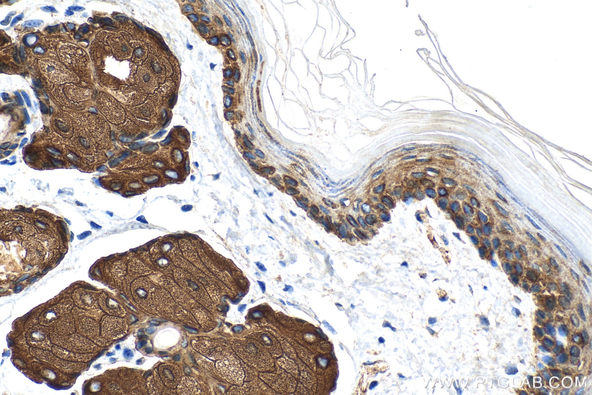 Immunohistochemistry (IHC) staining of mouse skin tissue using Cytokeratin 14 Recombinant antibody (82824-1-RR)