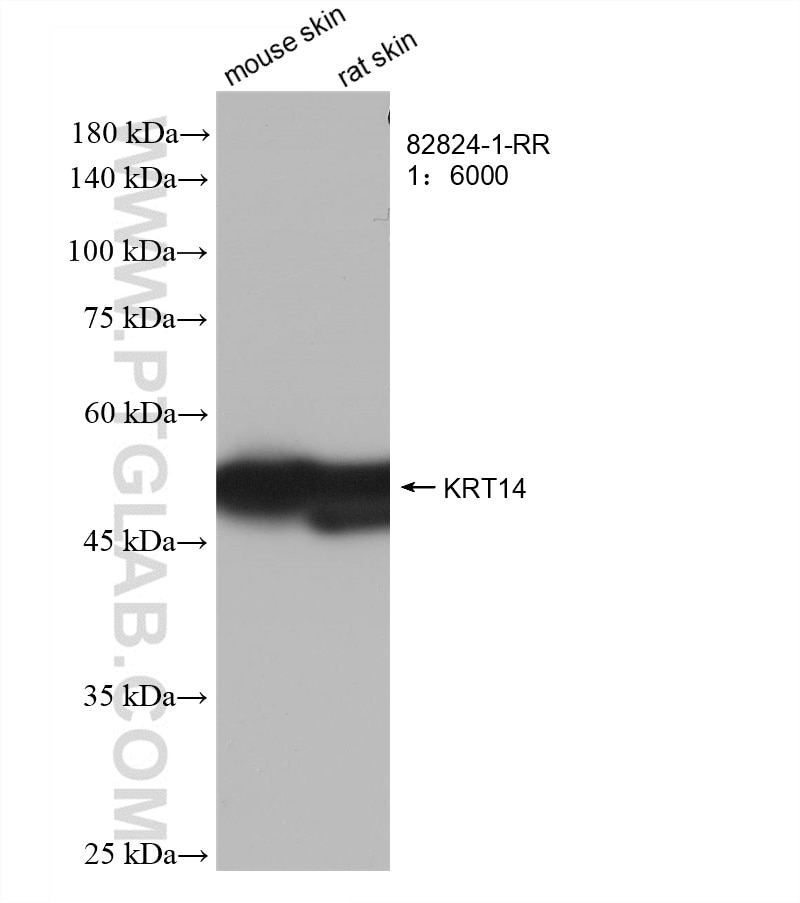 Western Blot (WB) analysis of various lysates using Cytokeratin 14 Recombinant antibody (82824-1-RR)