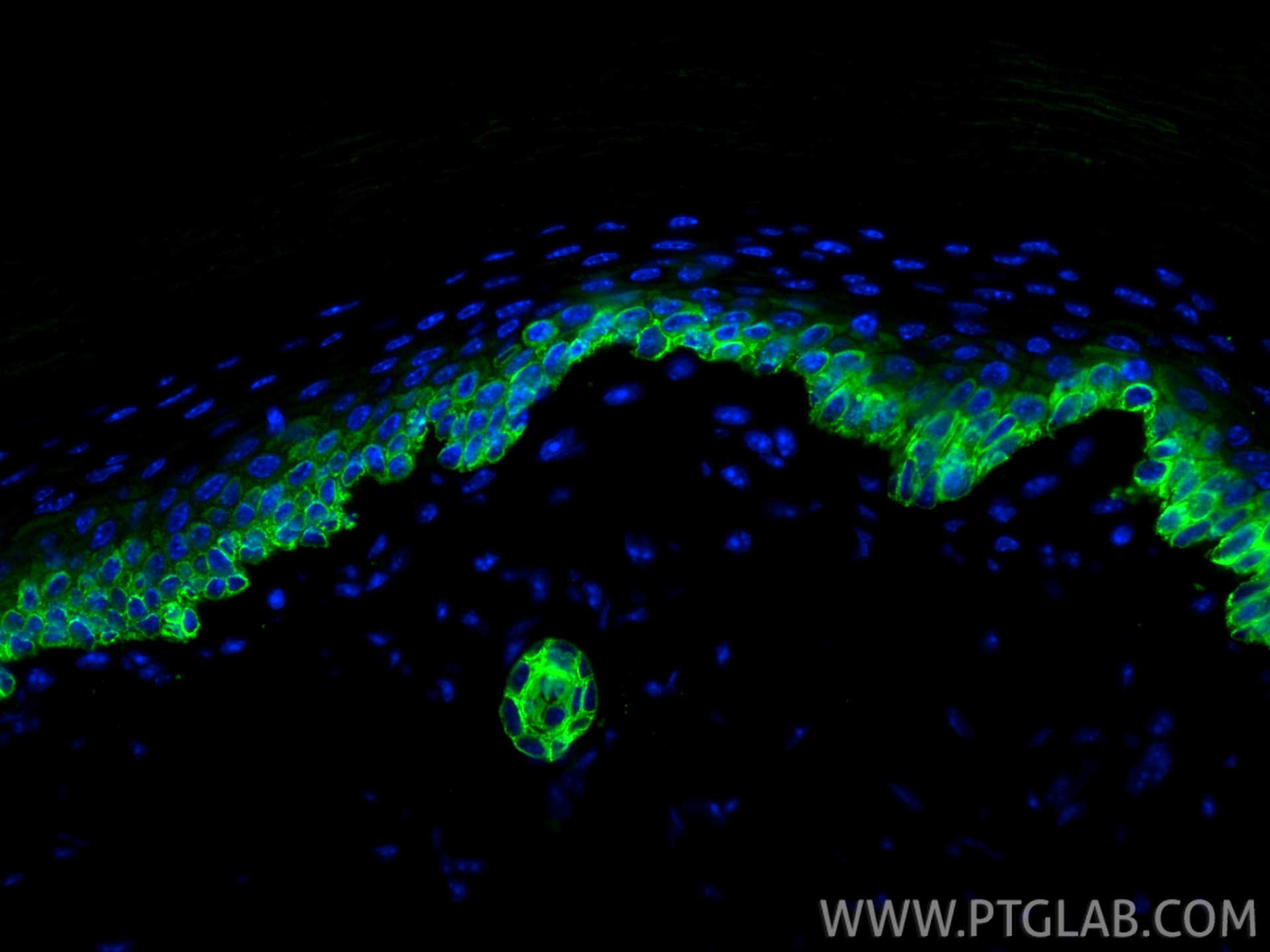Immunofluorescence (IF) / fluorescent staining of mouse skin tissue using Cytokeratin 14 Recombinant antibody (83379-1-RR)