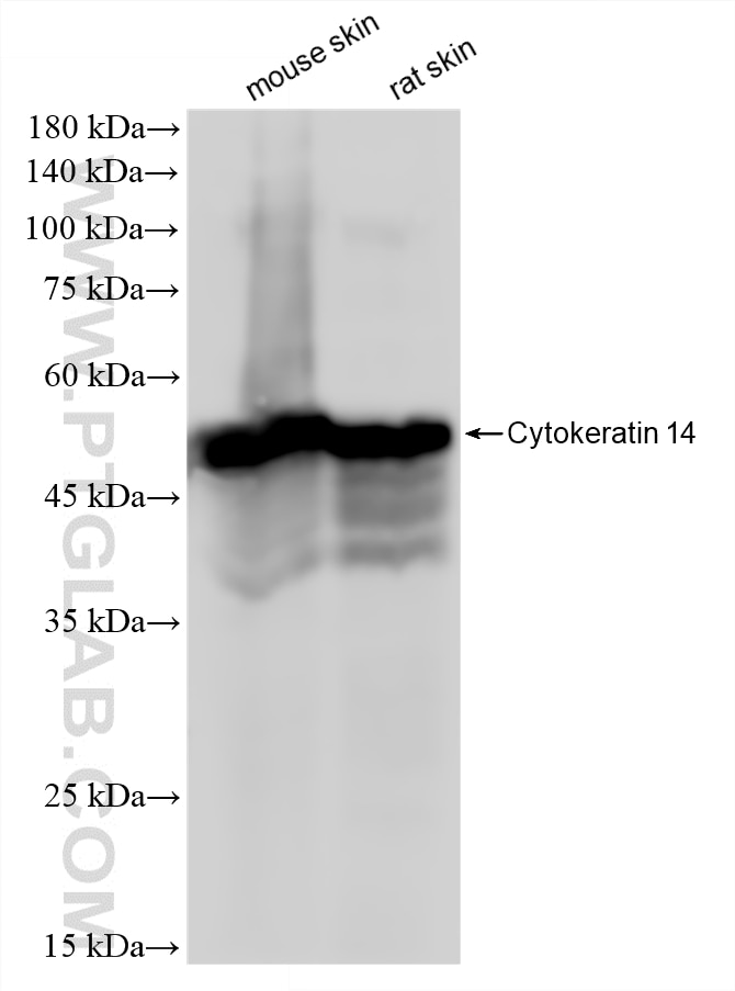 Western Blot (WB) analysis of various lysates using Cytokeratin 14 Recombinant monoclonal antibody (83379-1-RR)
