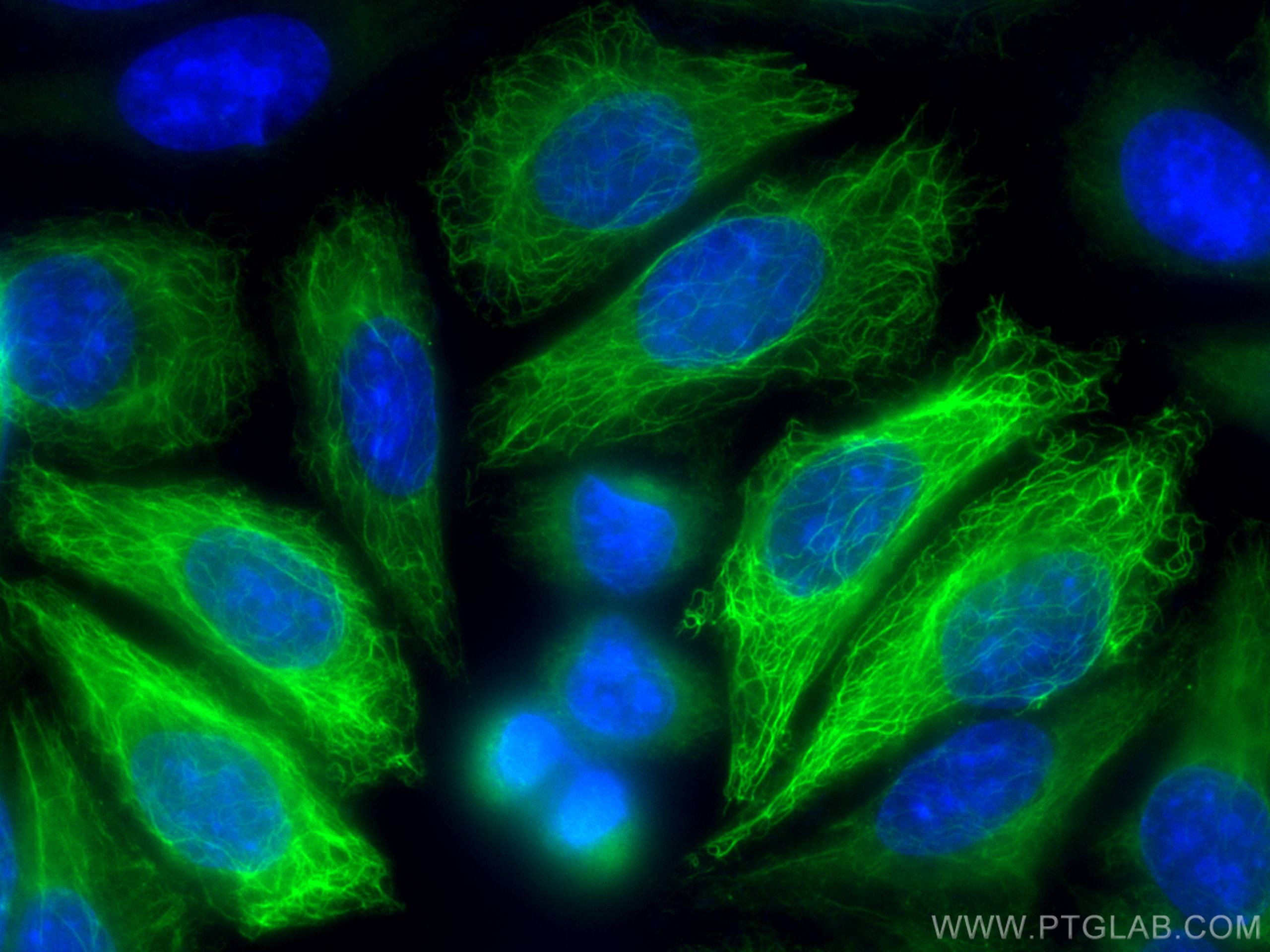 Immunofluorescence (IF) / fluorescent staining of HepG2 cells using CoraLite® Plus 488-conjugated Cytokeratin 14 Polyc (CL488-10143)