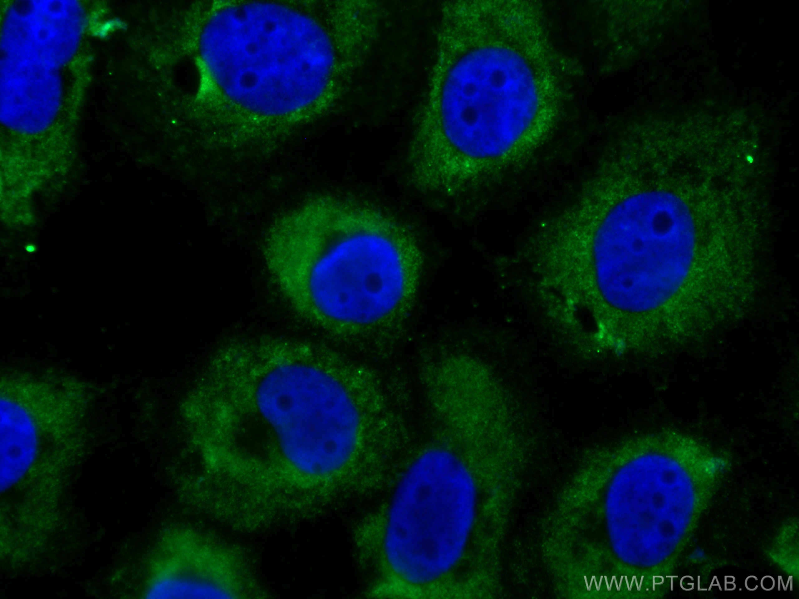 Immunofluorescence (IF) / fluorescent staining of A431 cells using CoraLite®488-conjugated Cytokeratin 14 Monoclonal  (CL488-60320)