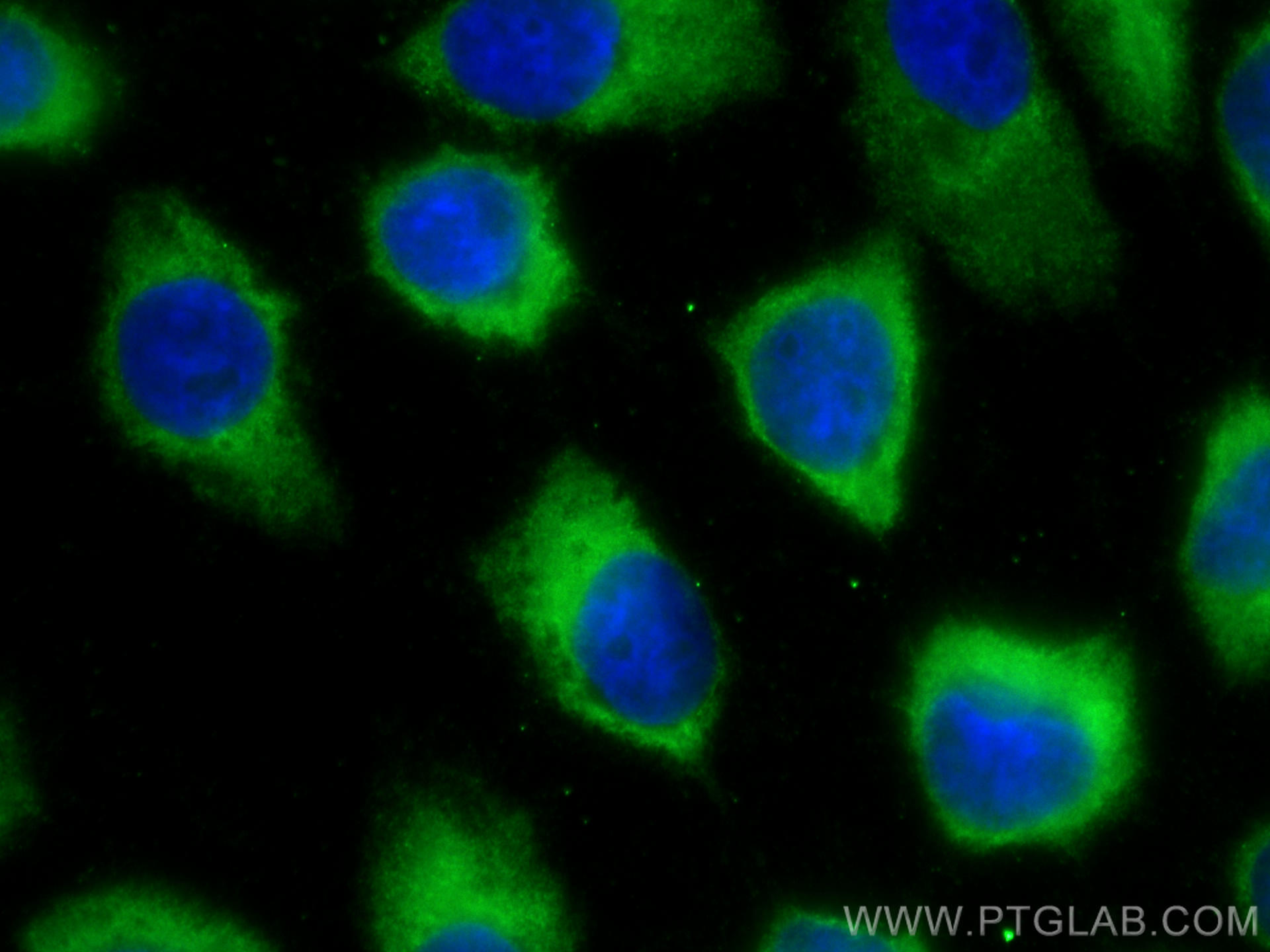 Immunofluorescence (IF) / fluorescent staining of A431 cells using CoraLite®488-conjugated Cytokeratin 14 Monoclonal  (CL488-60320)