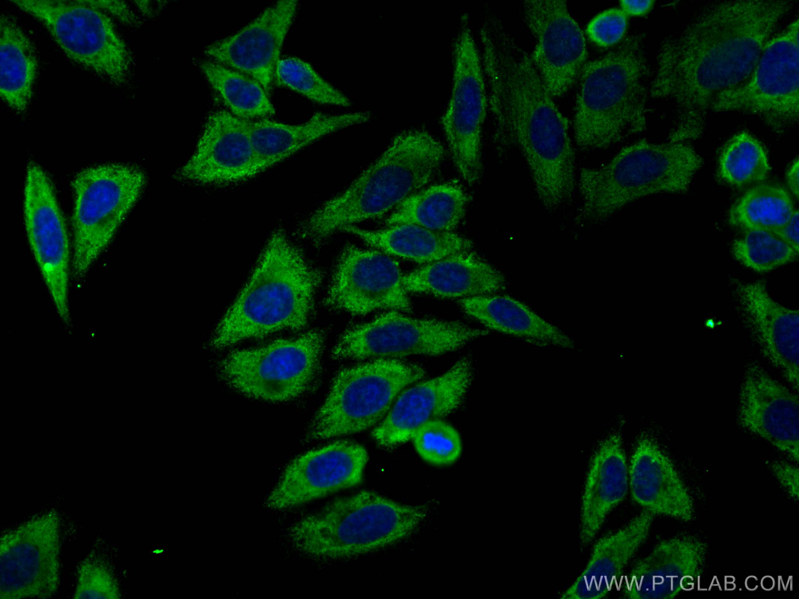 Immunofluorescence (IF) / fluorescent staining of HepG2 cells using CoraLite®488-conjugated Cytokeratin 14 Monoclonal  (CL488-60320)