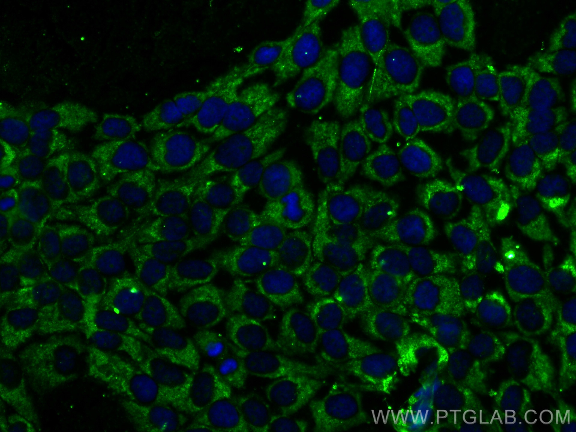 Immunofluorescence (IF) / fluorescent staining of HaCaT cells using CoraLite®488-conjugated Cytokeratin 14 Monoclonal  (CL488-60320)