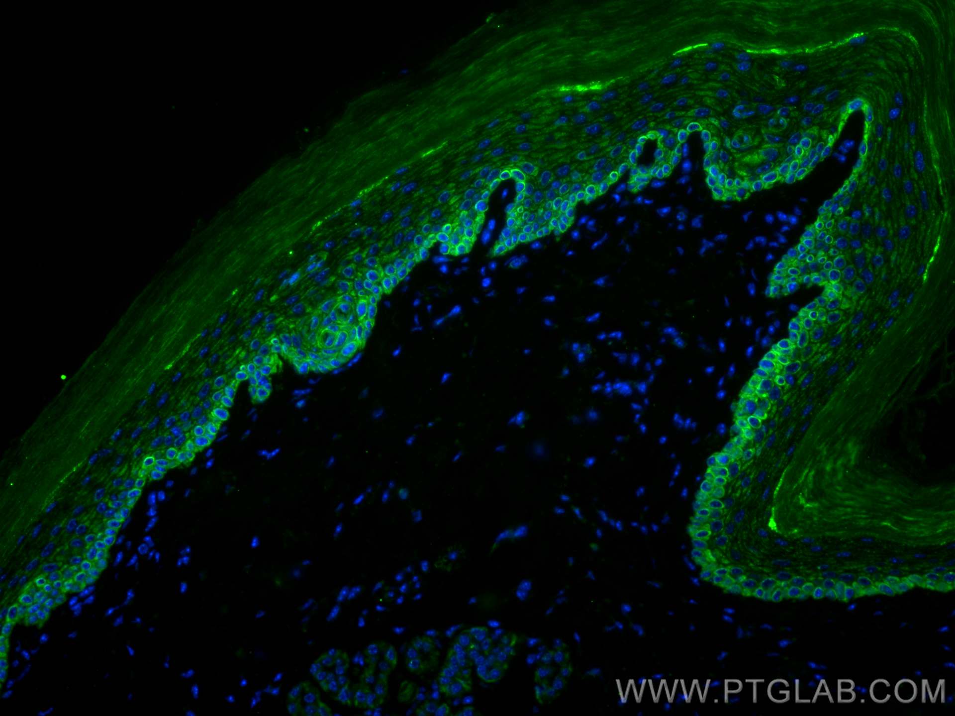 Immunofluorescence (IF) / fluorescent staining of mouse skin tissue using CoraLite®488-conjugated Cytokeratin 14 Monoclonal  (CL488-60320)