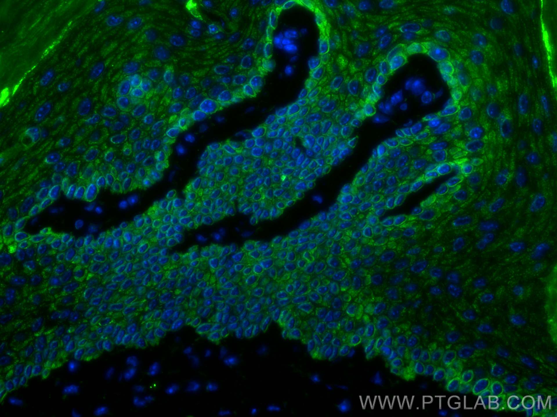 Immunofluorescence (IF) / fluorescent staining of mouse skin tissue using CoraLite®488-conjugated Cytokeratin 14 Monoclonal  (CL488-60320)