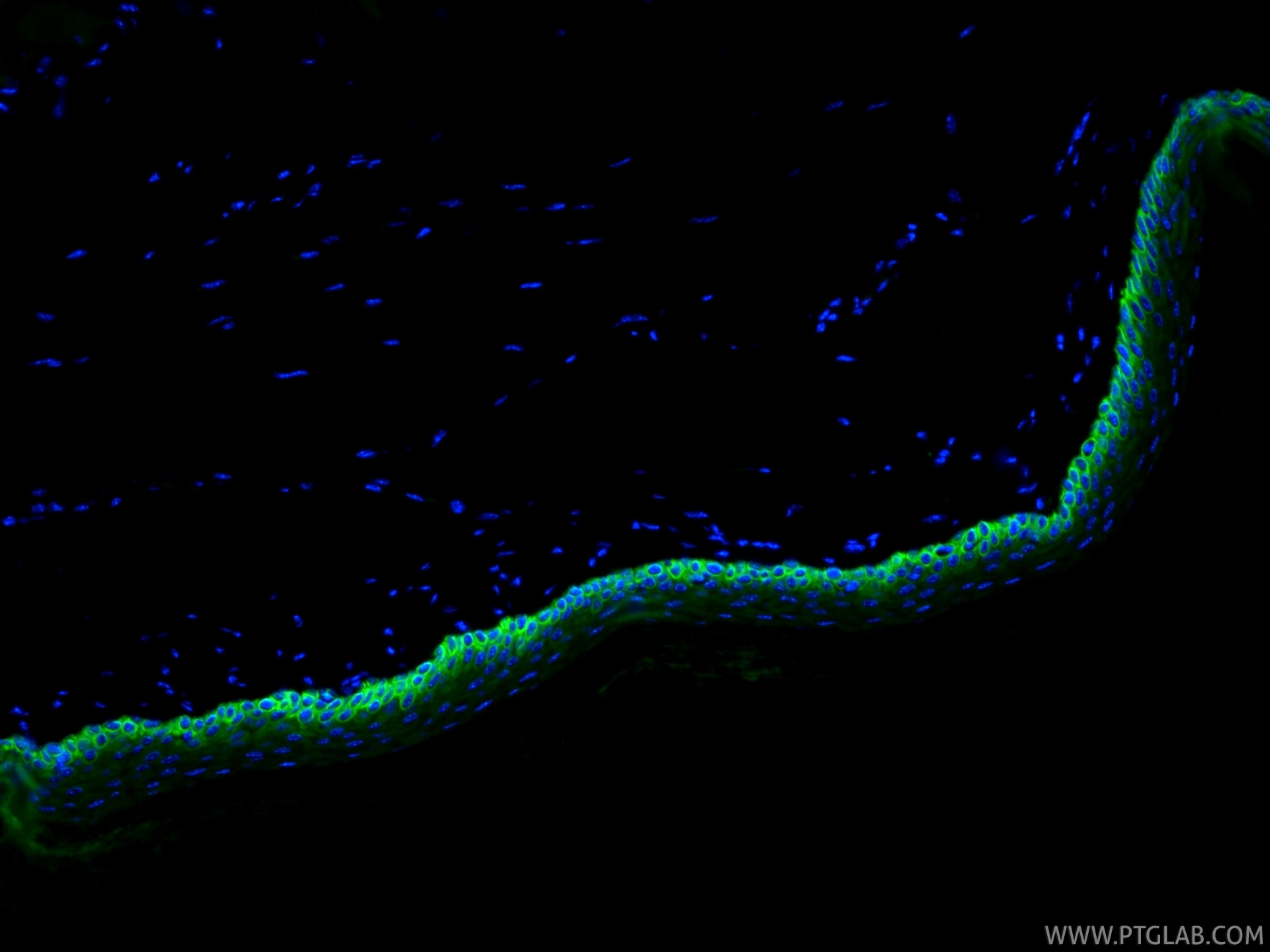 Immunofluorescent analysis of (4% PFA) fixed paraffin-embedded mouse skin tissue using CoraLite® Plus 488 Cytokeratin 14 antibody (CL488-82824, Clone: 1L19 ) at dilution of 1:200. Heat mediated antigen retrieval with Tris-EDTA buffer (pH 9.0). Immunofluorescence (IF) / fluorescent staining of mouse skin tissue using CoraLite® Plus 488-conjugated Cytokeratin 14 Recom (CL488-82824)