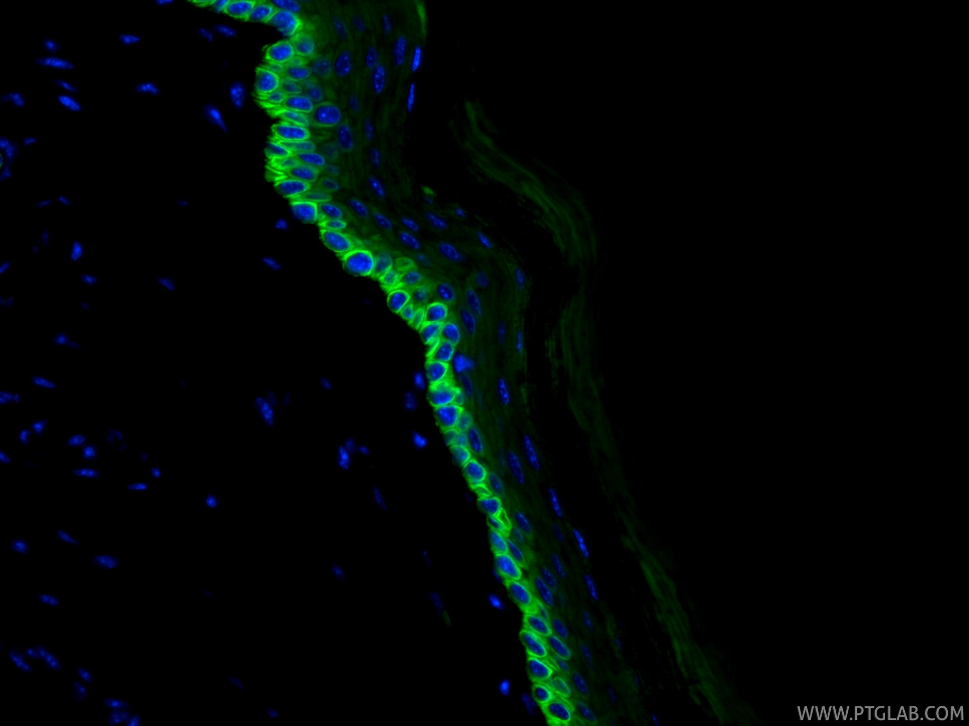 Immunofluorescent analysis of (4% PFA) fixed paraffin-embedded mouse skin tissue using CoraLite® Plus 488 Cytokeratin 14 antibody (CL488-82824, Clone: 1L19 ) at dilution of 1:200. Heat mediated antigen retrieval with Tris-EDTA buffer (pH 9.0). Immunofluorescence (IF) / fluorescent staining of mouse skin tissue using CoraLite® Plus 488-conjugated Cytokeratin 14 Recom (CL488-82824)