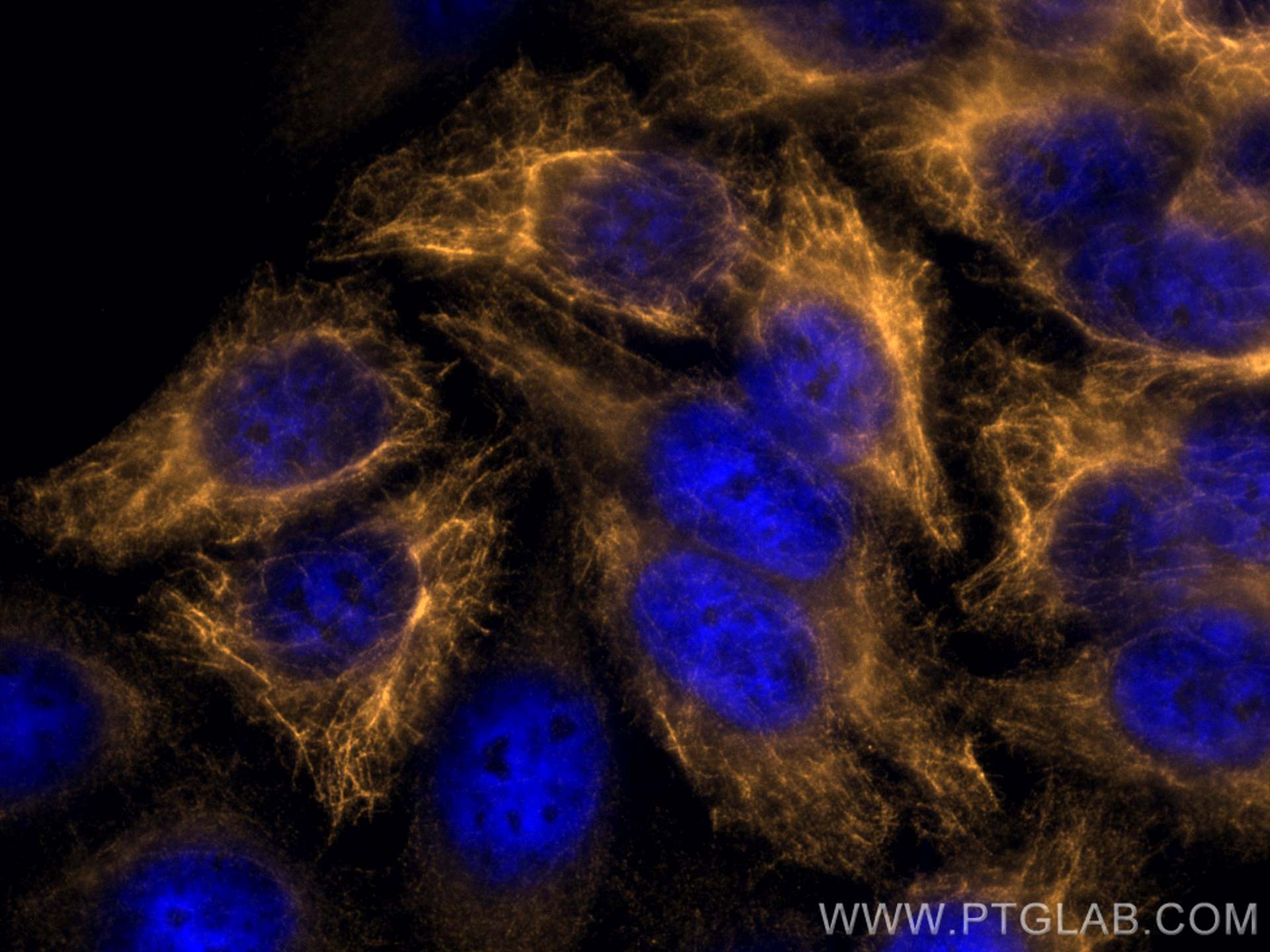 Immunofluorescence (IF) / fluorescent staining of HepG2 cells using CoraLite® Plus 555-conjugated Cytokeratin 14 Polyc (CL555-10143)