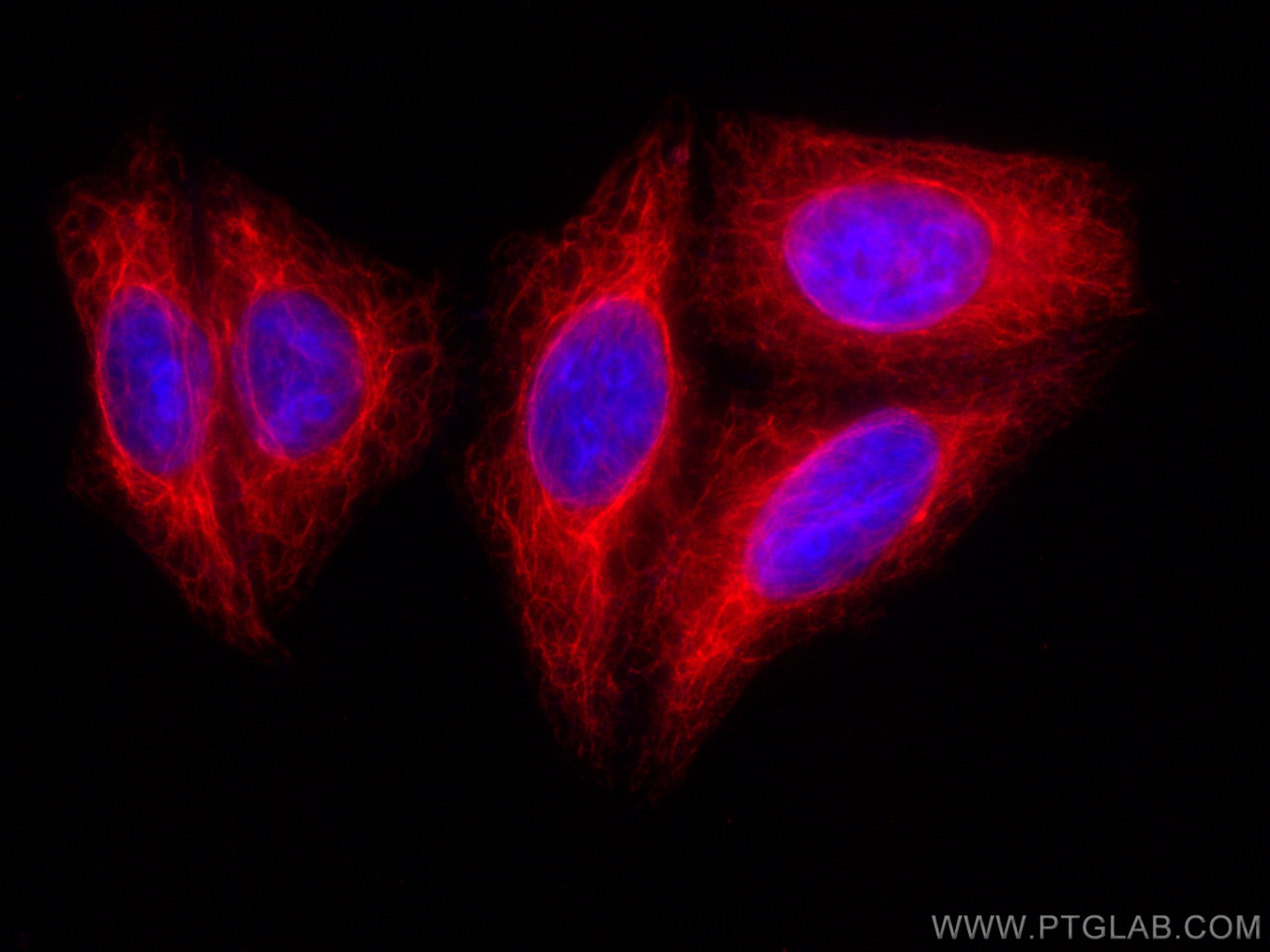 Immunofluorescence (IF) / fluorescent staining of HepG2 cells using CoraLite®594-conjugated Cytokeratin 14 Polyclonal  (CL594-10143)