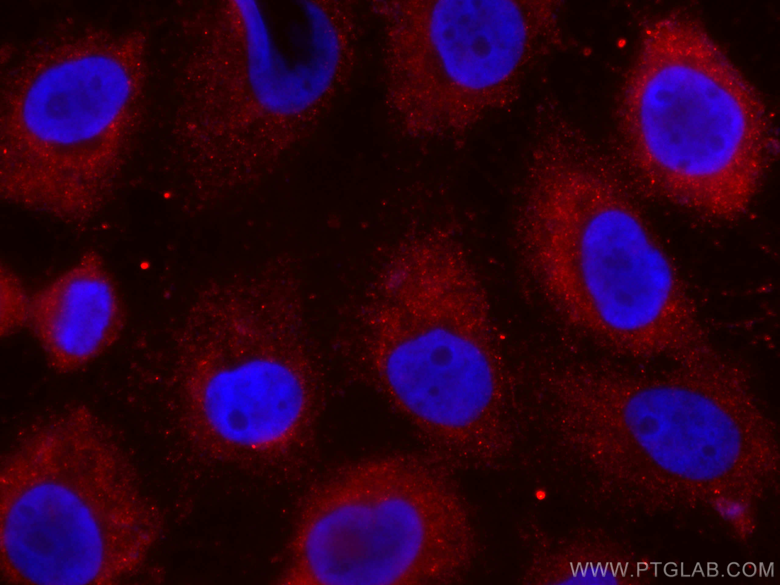 Immunofluorescence (IF) / fluorescent staining of A431 cells using CoraLite®594-conjugated Cytokeratin 14 Monoclonal  (CL594-60320)