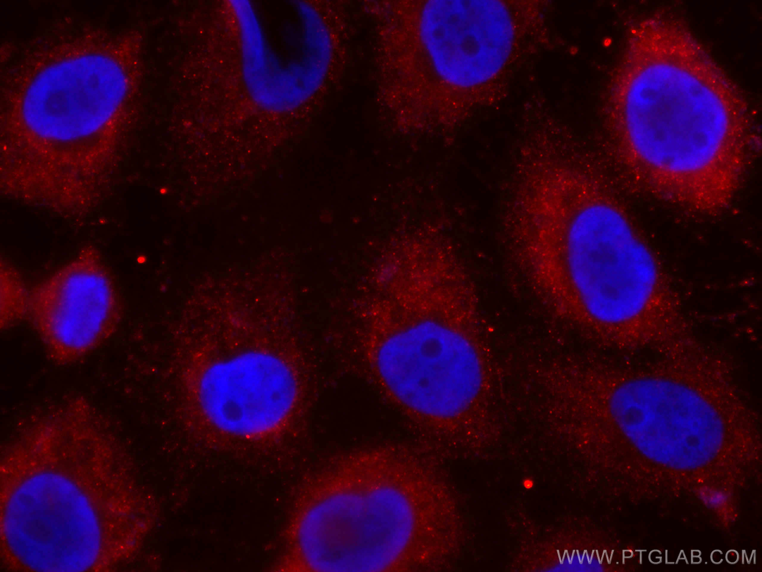 IF Staining of A431 using CL594-60320