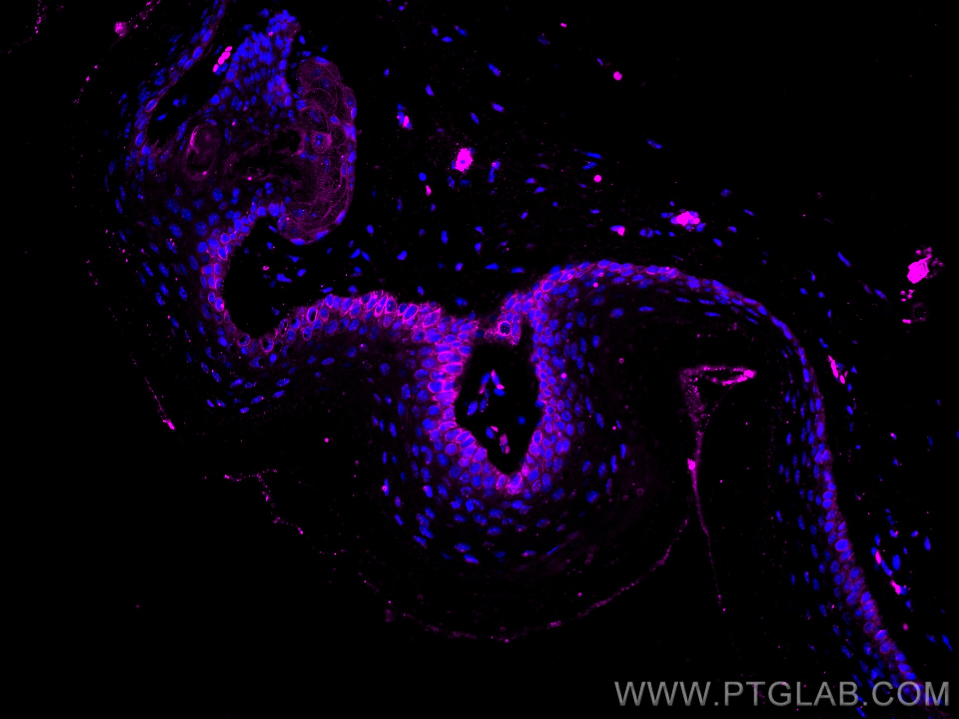 Immunofluorescence (IF) / fluorescent staining of mouse skin tissue using CoraLite® Plus 647-conjugated Cytokeratin 14 Monoc (CL647-60320)