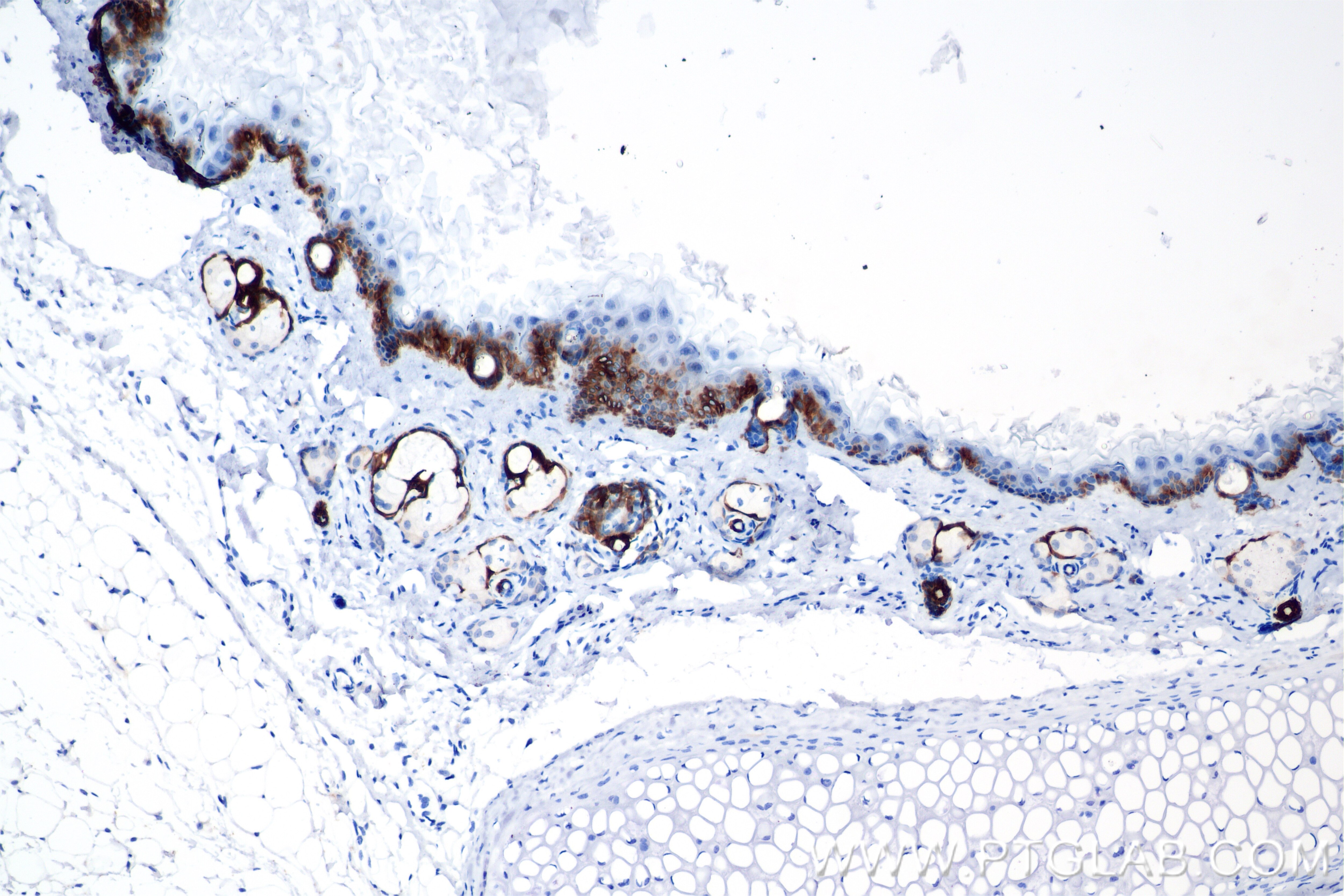 Immunohistochemistry (IHC) staining of mouse skin tissue using Cytokeratin 15 Recombinant monoclonal antibody (86761-3-RR)