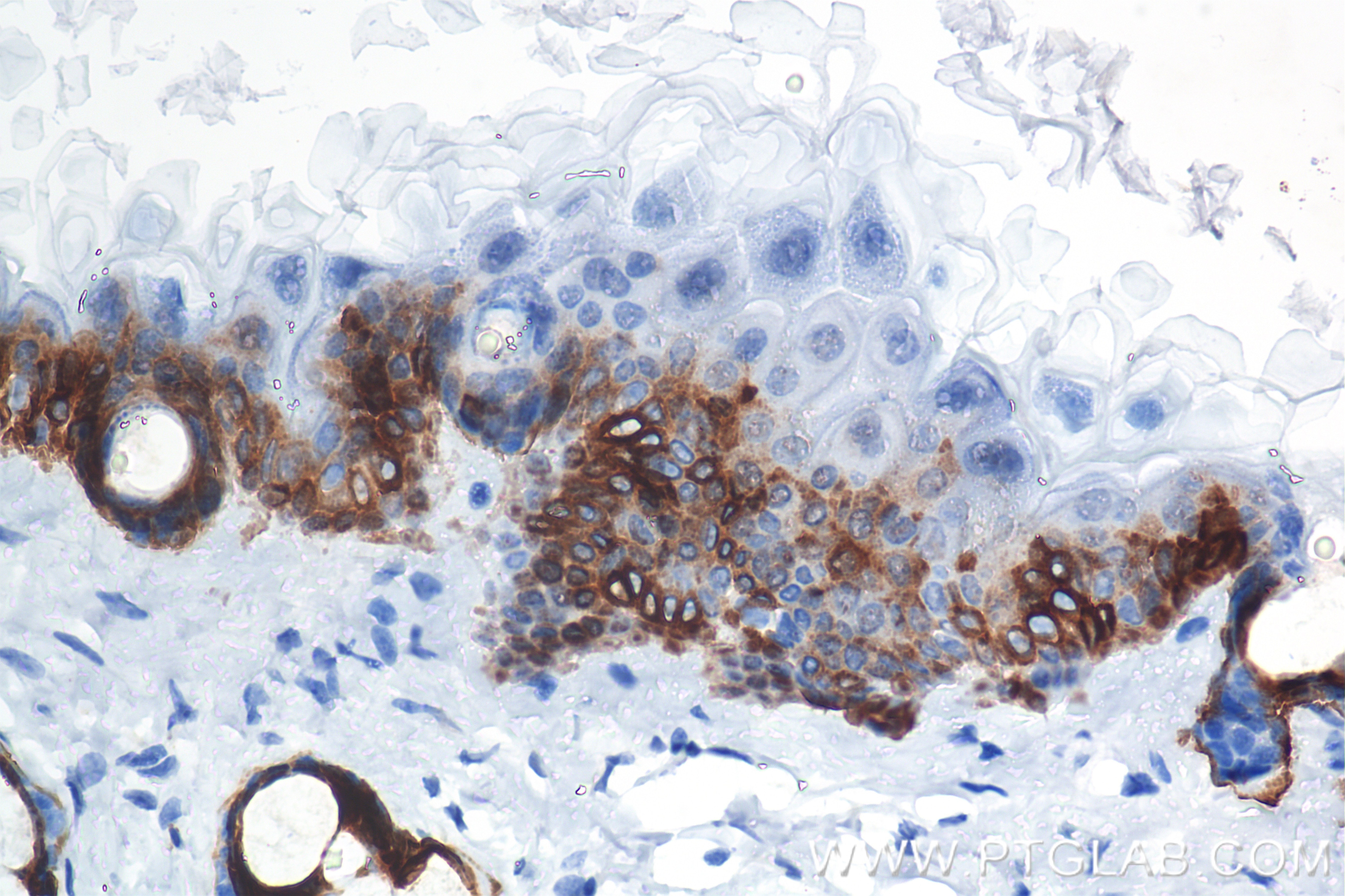 Immunohistochemistry (IHC) staining of mouse skin tissue using Cytokeratin 15 Recombinant monoclonal antibody (86761-3-RR)
