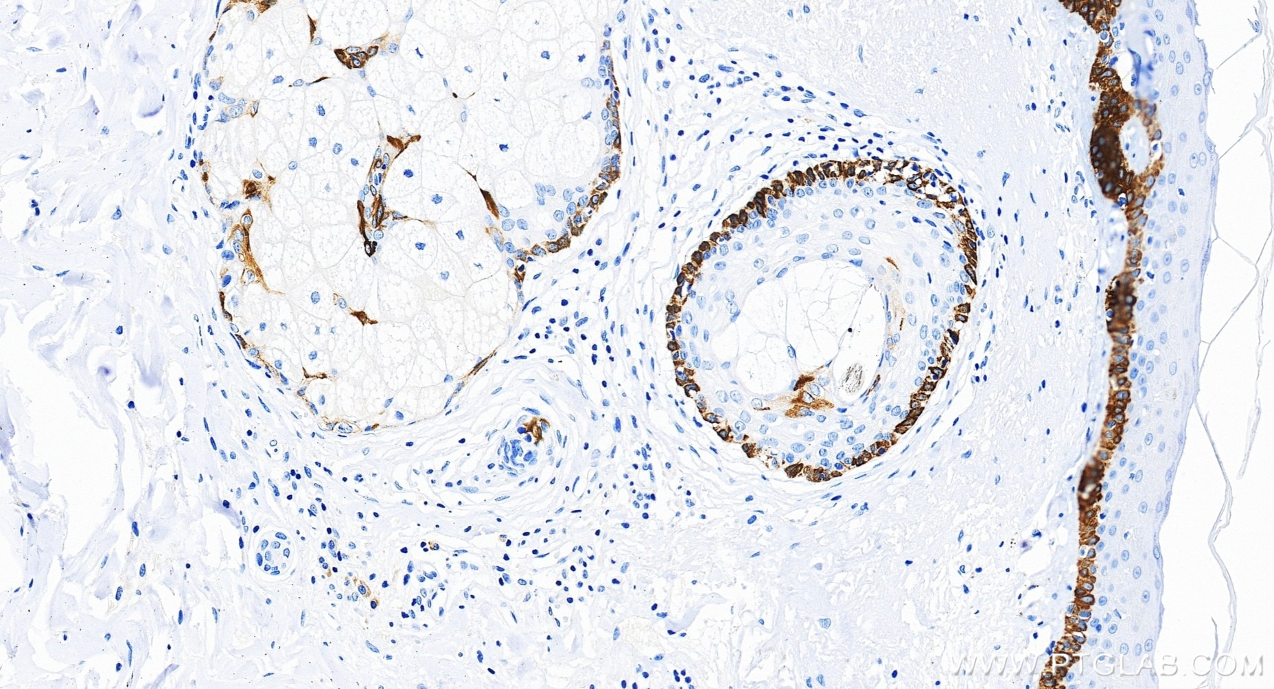 Immunohistochemistry (IHC) staining of human skin tissue using Cytokeratin 15 Recombinant monoclonal antibody (86761-3-RR)