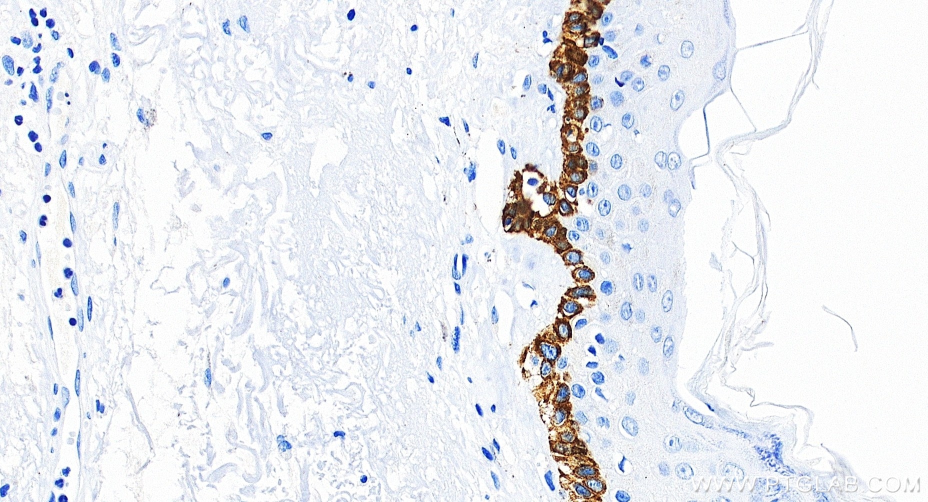 Immunohistochemistry (IHC) staining of human skin tissue using Cytokeratin 15 Recombinant monoclonal antibody (86761-3-RR)