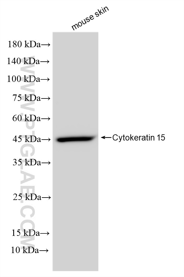 Western Blot (WB) analysis of various lysates using Cytokeratin 15 Recombinant monoclonal antibody (86761-3-RR)