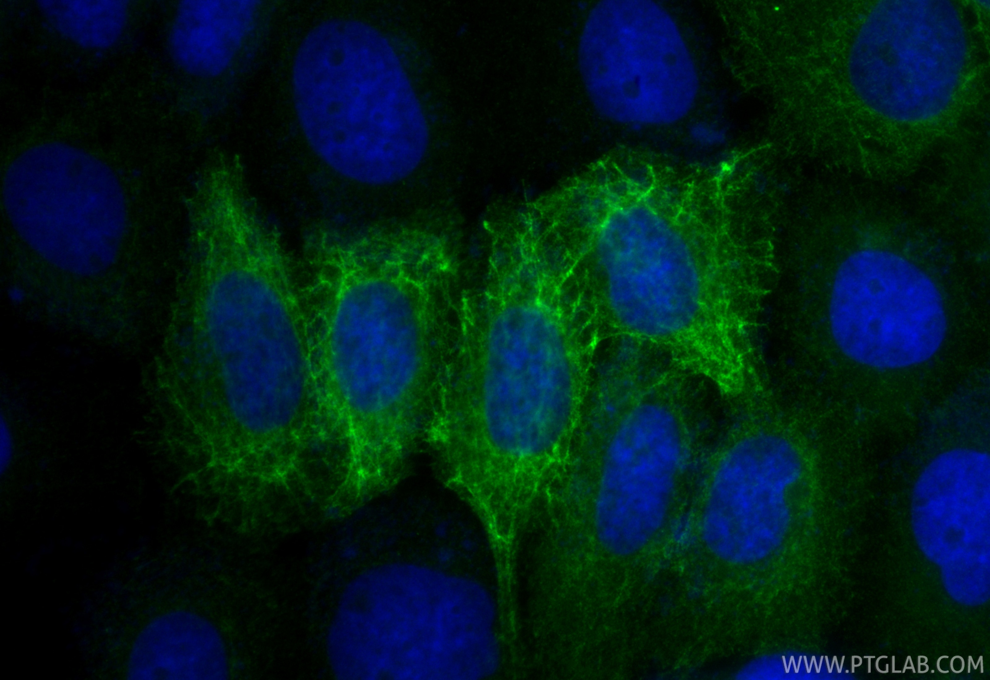 Immunofluorescence (IF) / fluorescent staining of A431 cells using CoraLite® Plus 488-conjugated Cytokeratin 15 Polyc (CL488-10137)
