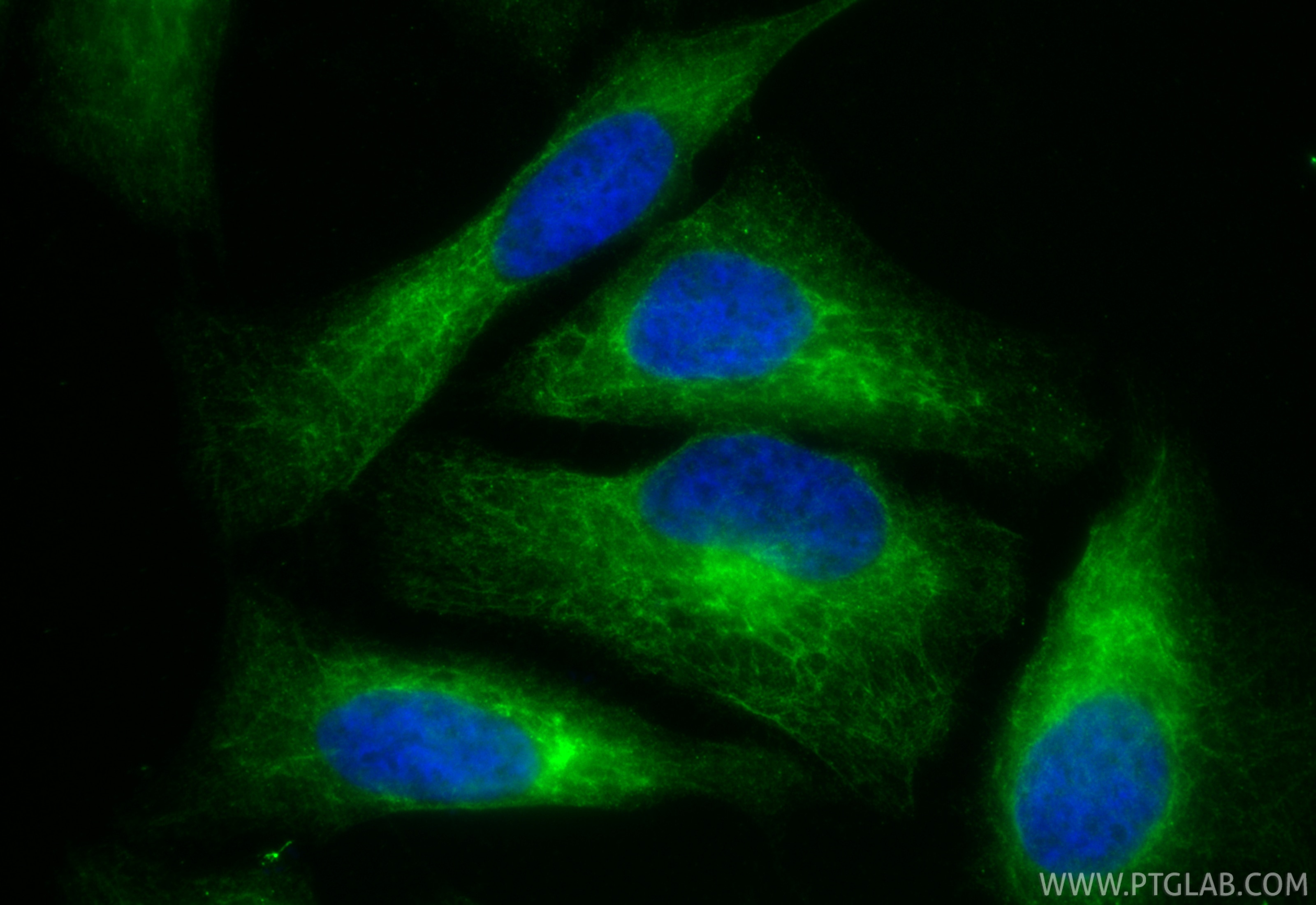Immunofluorescence (IF) / fluorescent staining of HeLa cells using CoraLite® Plus 488-conjugated Cytokeratin 15 Polyc (CL488-10137)
