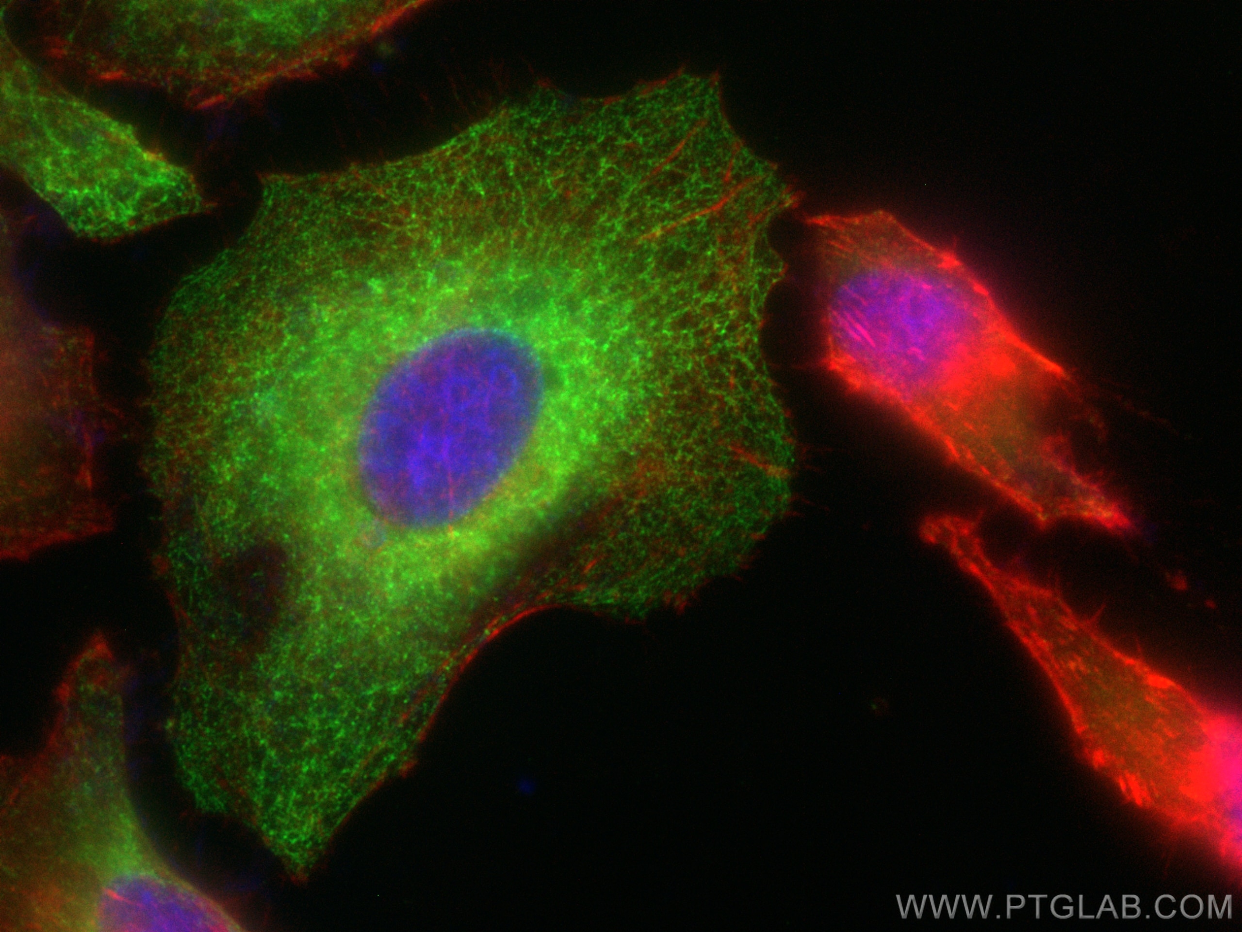 Cytokeratin 15