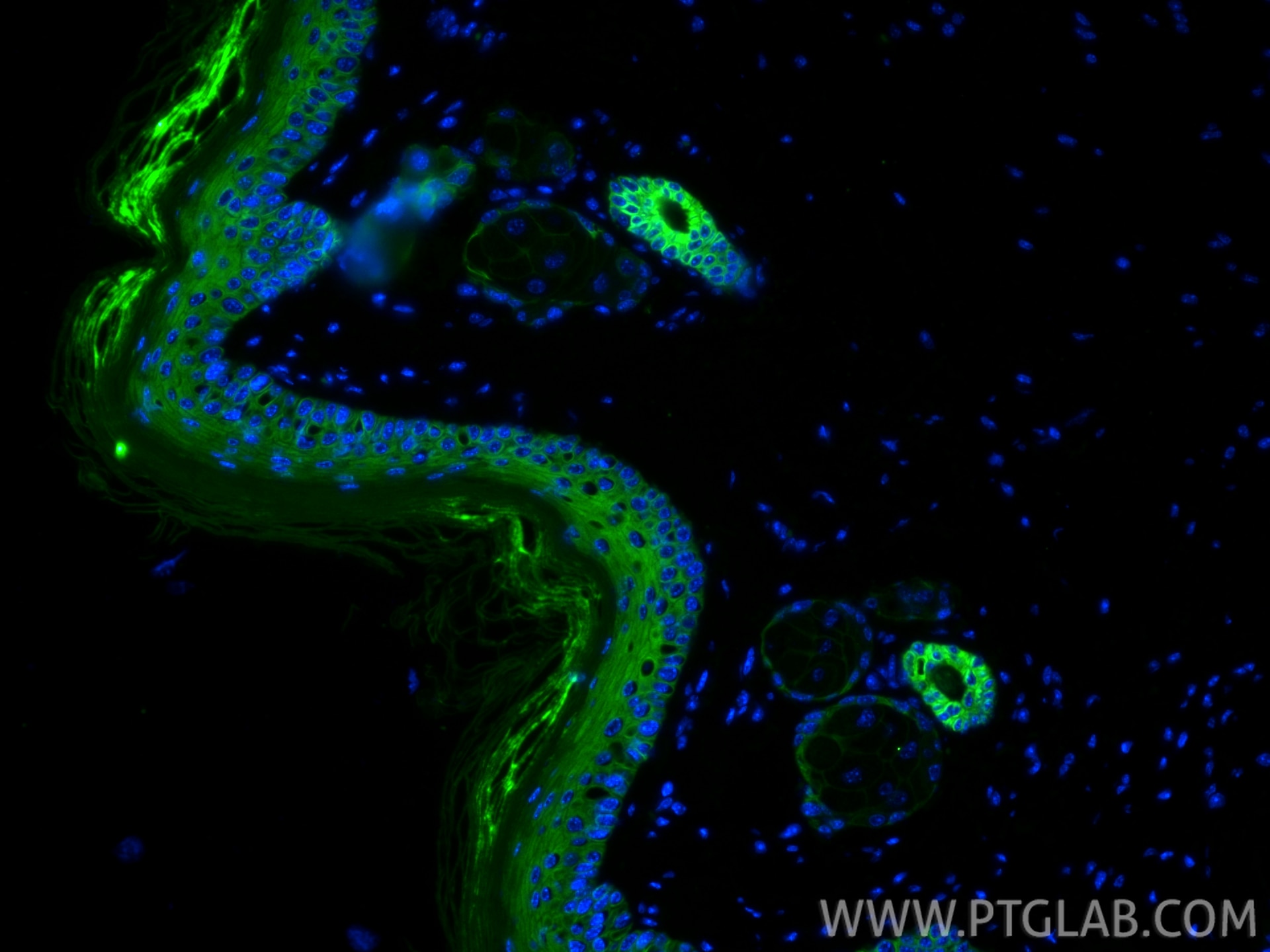 Immunofluorescence (IF) / fluorescent staining of mouse skin tissue using CoraLite® Plus 488-conjugated Cytokeratin 15 Monoc (CL488-60247)