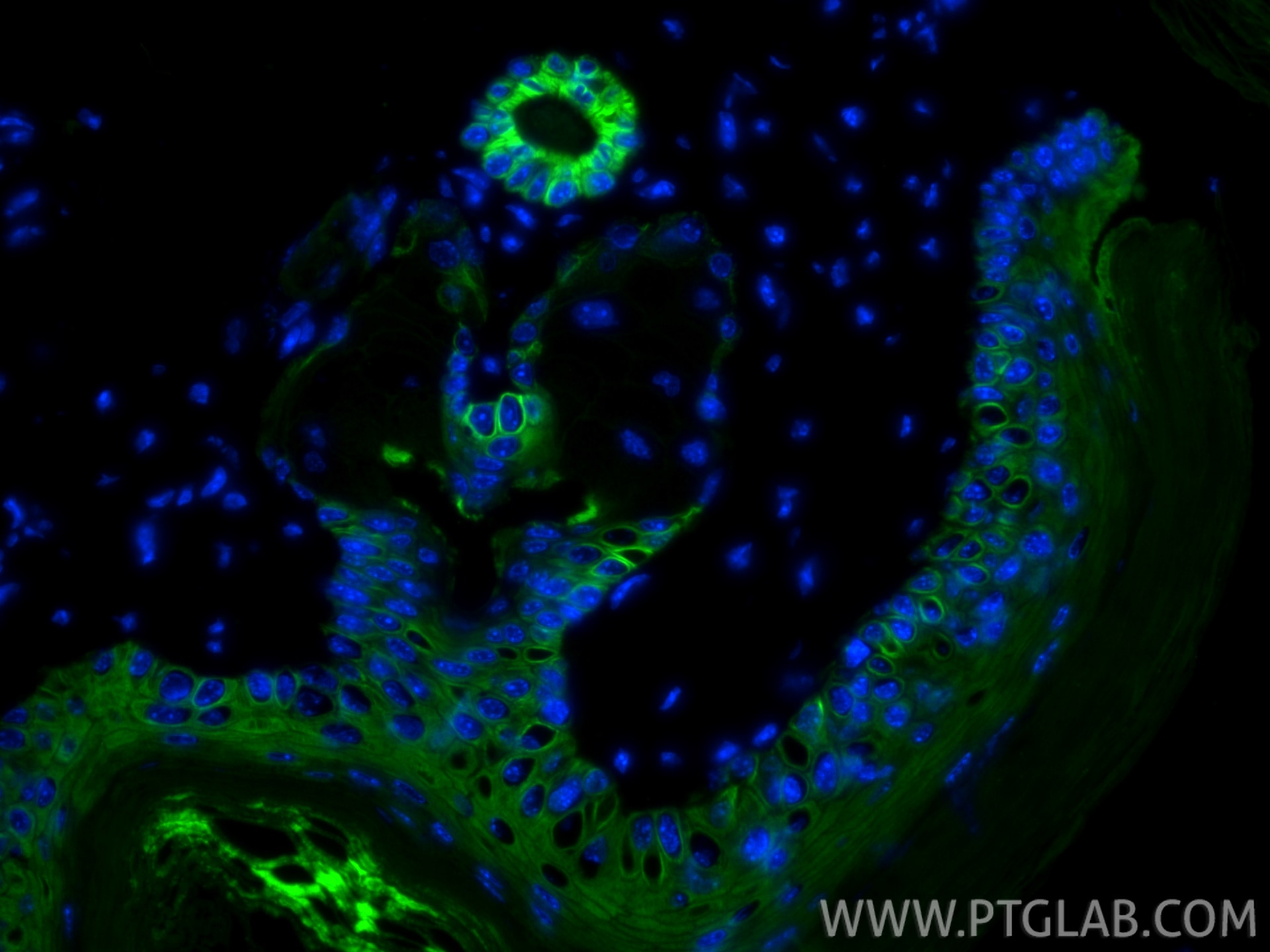 Immunofluorescence (IF) / fluorescent staining of mouse skin tissue using CoraLite® Plus 488-conjugated Cytokeratin 15 Monoc (CL488-60247)