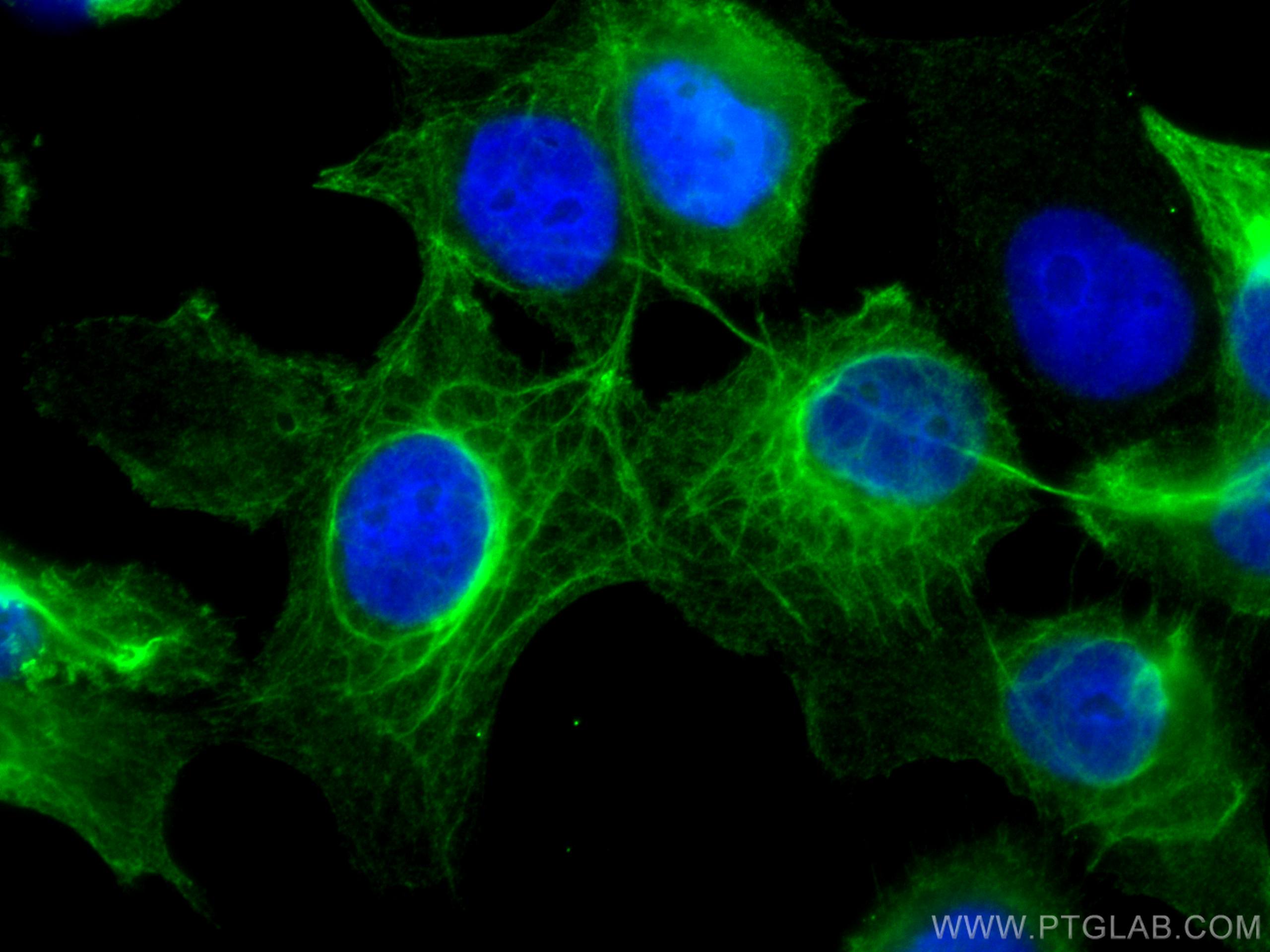 Immunofluorescence (IF) / fluorescent staining of A431 cells using Cytokeratin 16 Monoclonal antibody (66802-1-Ig)