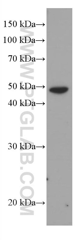 Western Blot (WB) analysis of A549 cells using Cytokeratin 16 Monoclonal antibody (66802-1-Ig)