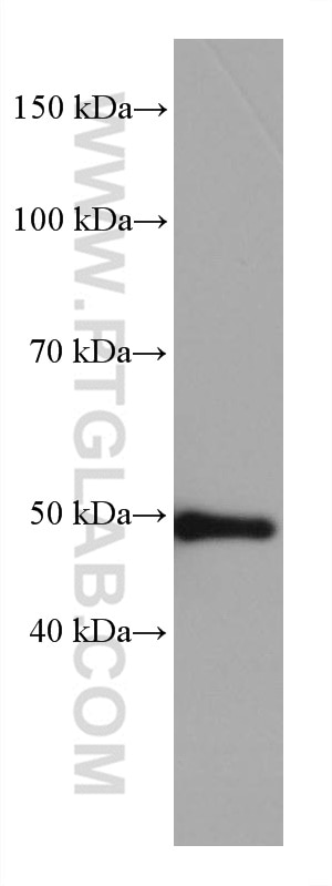 Western Blot (WB) analysis of human milk using Cytokeratin 16 Monoclonal antibody (66802-1-Ig)