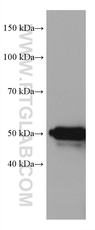 Western Blot (WB) analysis of A431 cells using Cytokeratin 16 Monoclonal antibody (66802-1-Ig)
