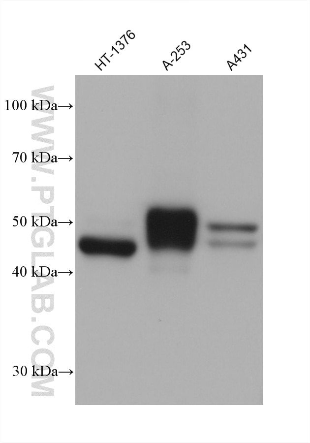 Western Blot (WB) analysis of various lysates using Cytokeratin 16 Monoclonal antibody (66802-1-Ig)