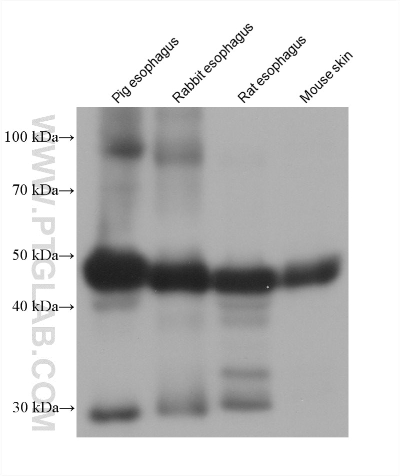 Western Blot (WB) analysis of various lysates using Cytokeratin 16 Monoclonal antibody (66802-1-Ig)