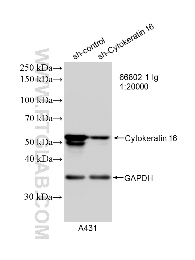 Western Blot (WB) analysis of A431 cells using Cytokeratin 16 Monoclonal antibody (66802-1-Ig)