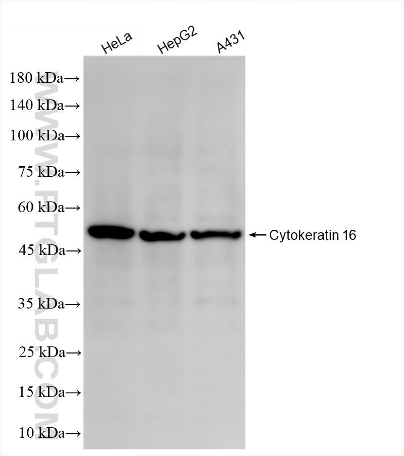 Western Blot (WB) analysis of various lysates using Cytokeratin 16 Recombinant antibody (86235-1-RR)