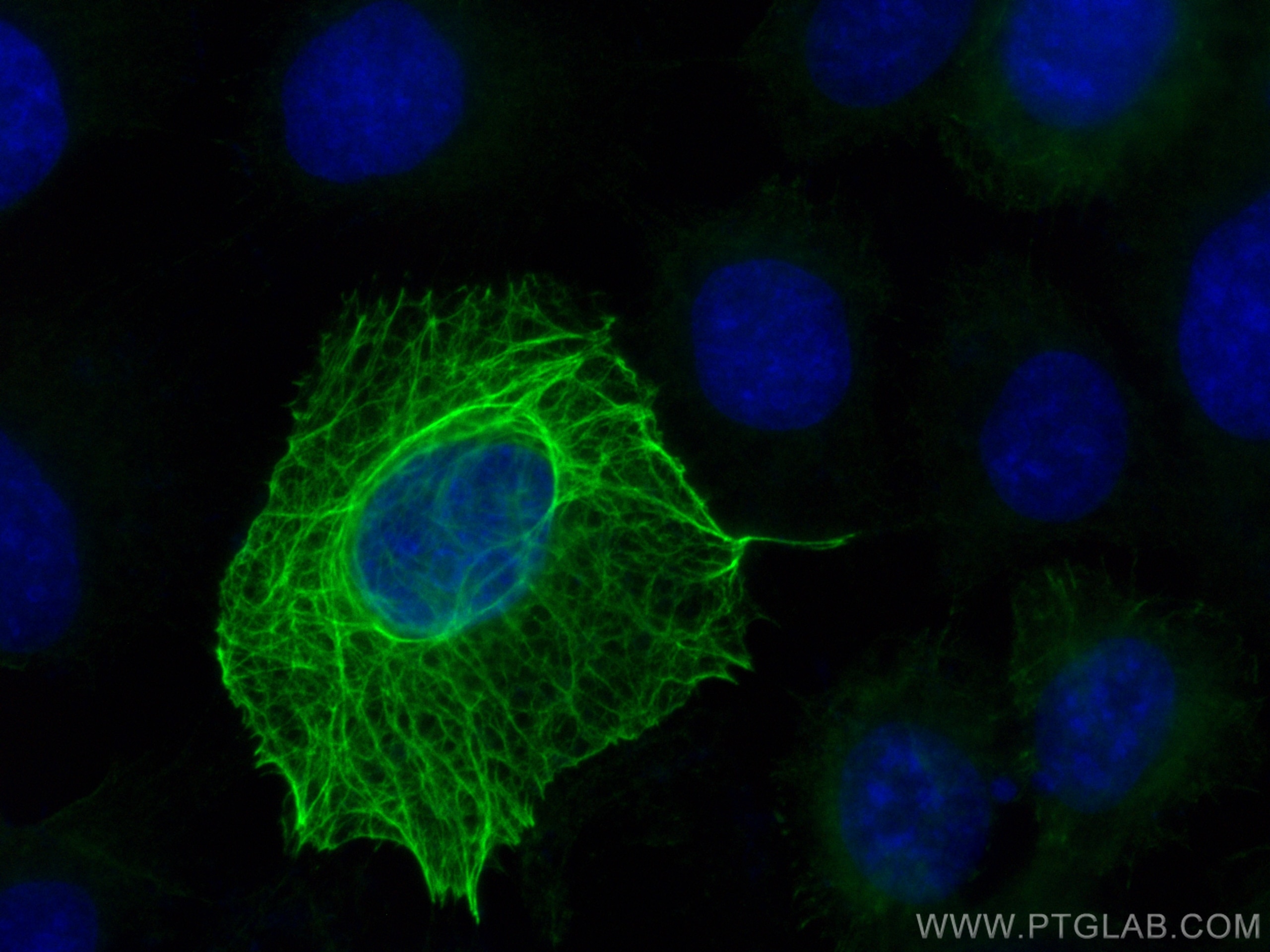 Cytokeratin 16