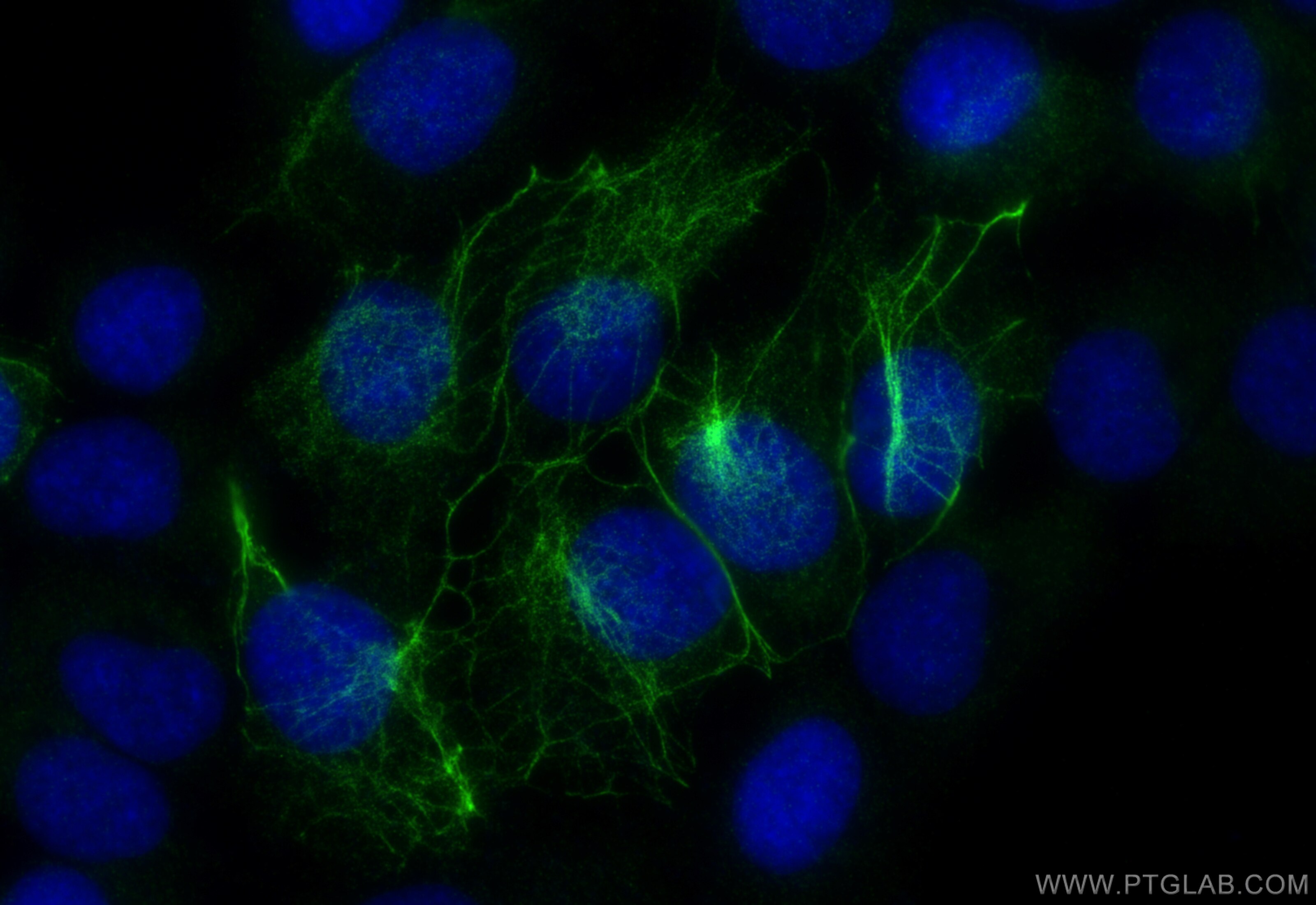 Immunofluorescence (IF) / fluorescent staining of HaCaT cells using Cytokeratin 17-specific Recombinant antibody (84978-1-RR)