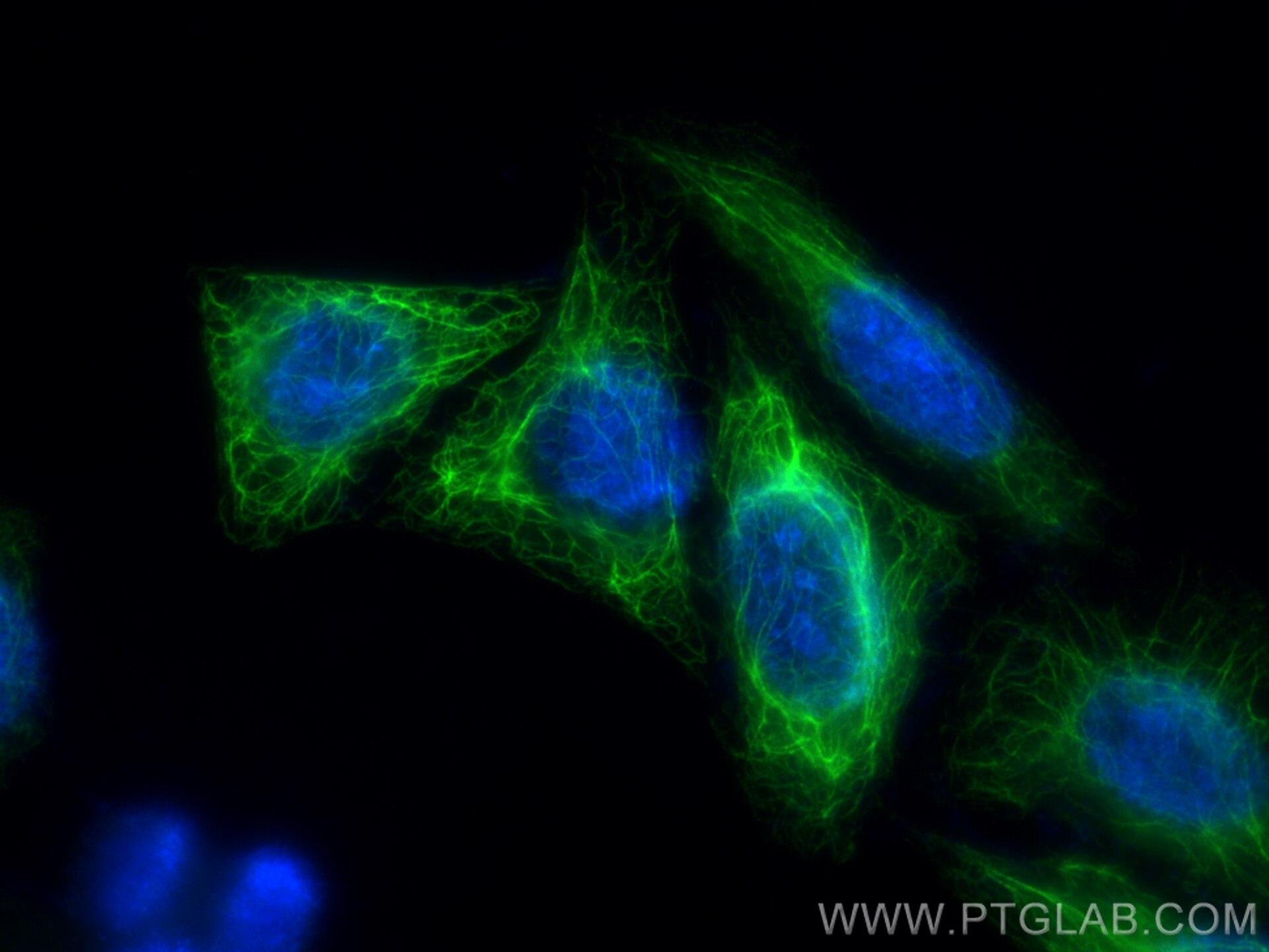Immunofluorescence (IF) / fluorescent staining of HepG2 cells using Cytokeratin 17-specific Recombinant antibody (84978-1-RR)