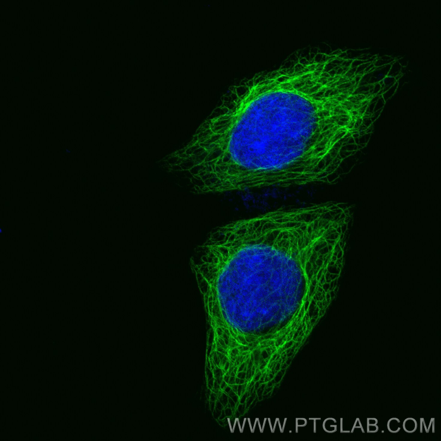 Immunofluorescence (IF) / fluorescent staining of HepG2 cells using Cytokeratin 17-specific Recombinant antibody (84978-1-RR)