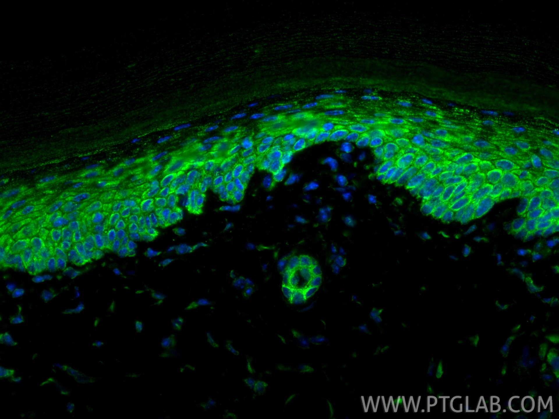 Immunofluorescence (IF) / fluorescent staining of mouse skin tissue using Cytokeratin 17-specific Recombinant antibody (84978-1-RR)