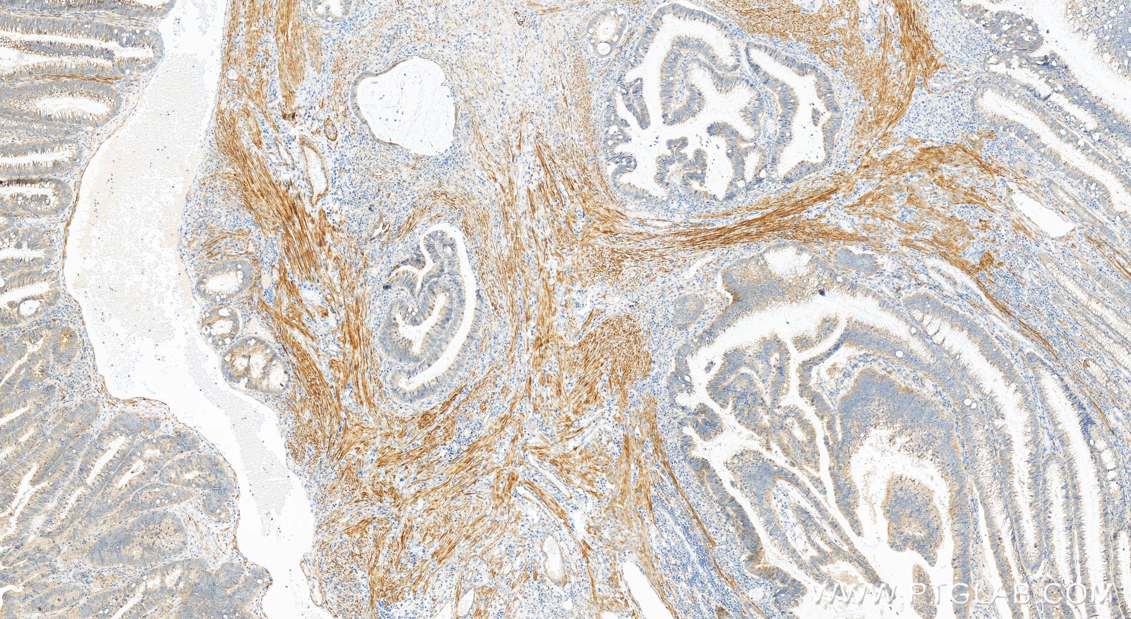 Cytokeratin 17-specific