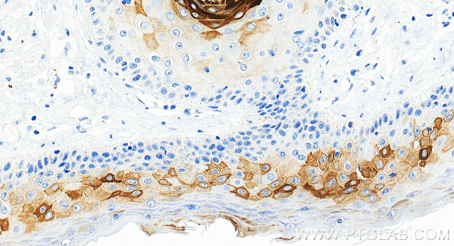 Immunohistochemistry (IHC) staining of human skin tissue using Cytokeratin 17-specific Recombinant monoclonal ant (84978-1-RR)