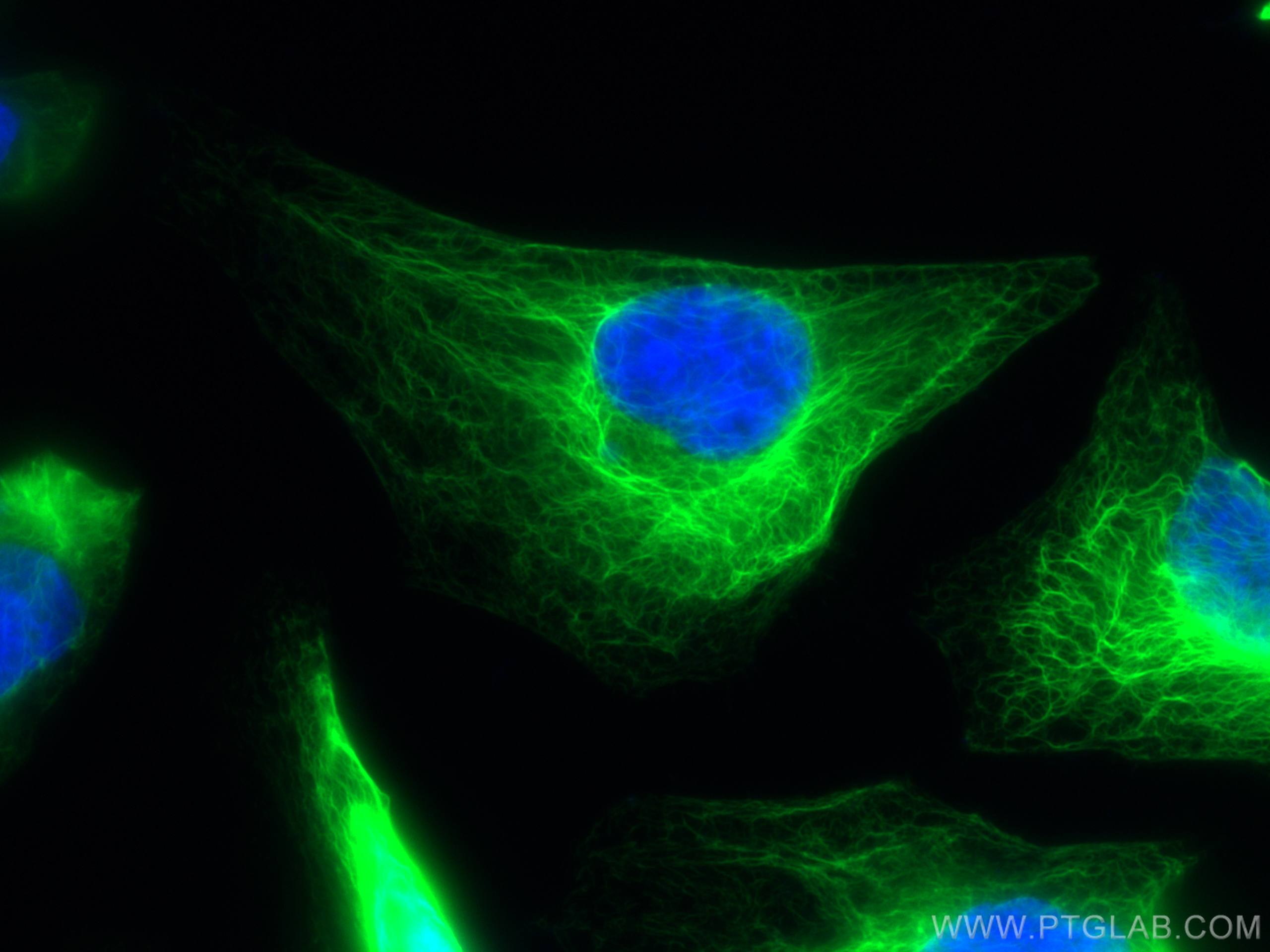Immunofluorescence (IF) / fluorescent staining of HeLa cells using CoraLite® Plus 488-conjugated Cytokeratin 17-Speci (CL488-17516)