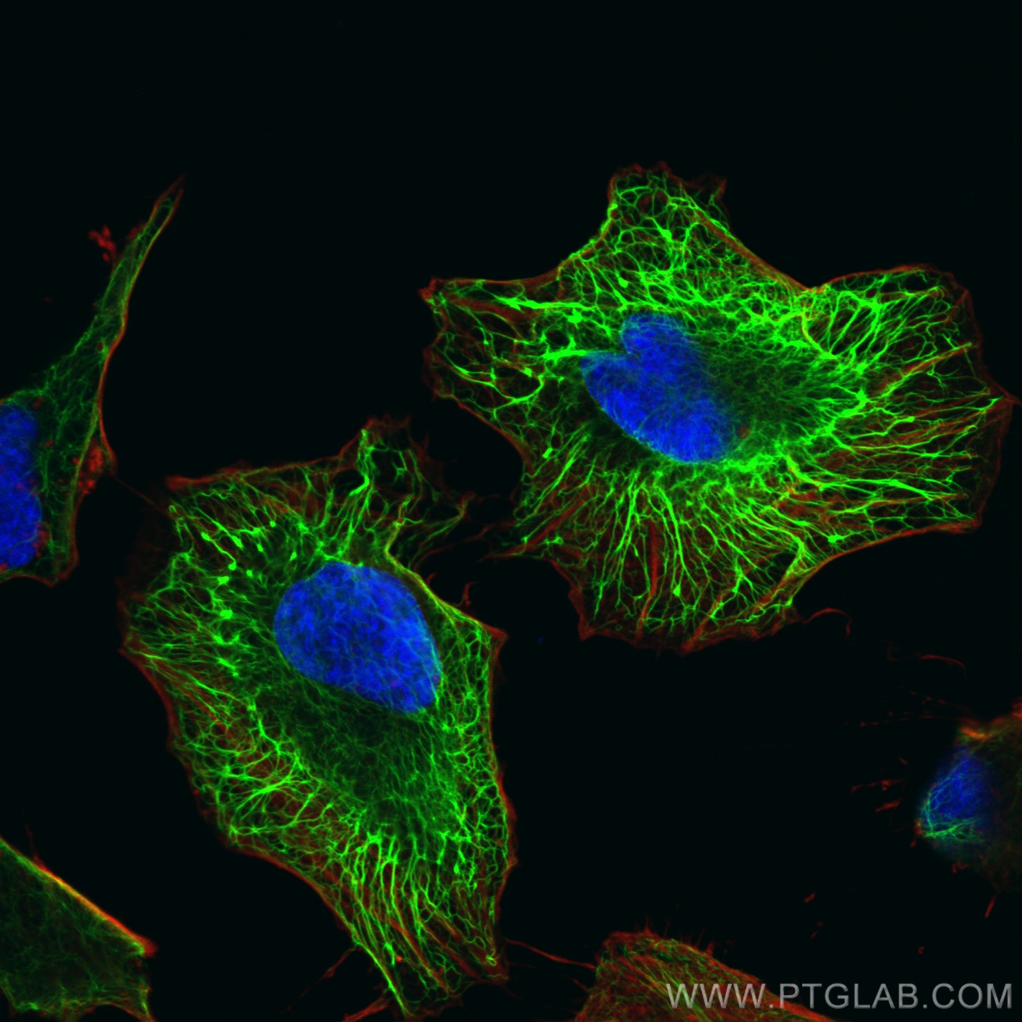 Immunofluorescence (IF) / fluorescent staining of HeLa cells using CoraLite® Plus 488-conjugated Cytokeratin 17-Speci (CL488-17516)