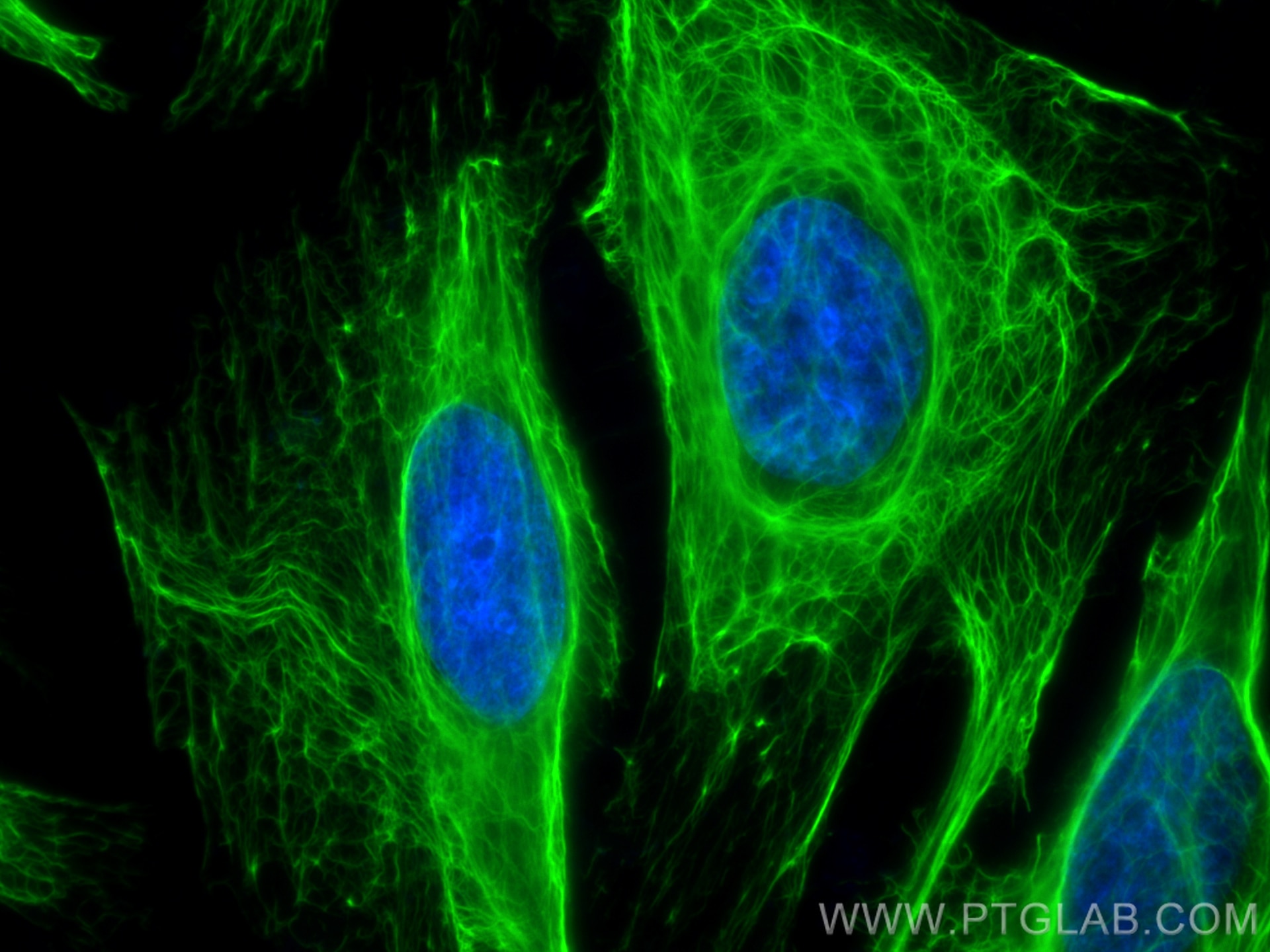 Immunofluorescence (IF) / fluorescent staining of HeLa cells using CoraLite® Plus 488-conjugated Cytokeratin 17-Speci (CL488-17516)
