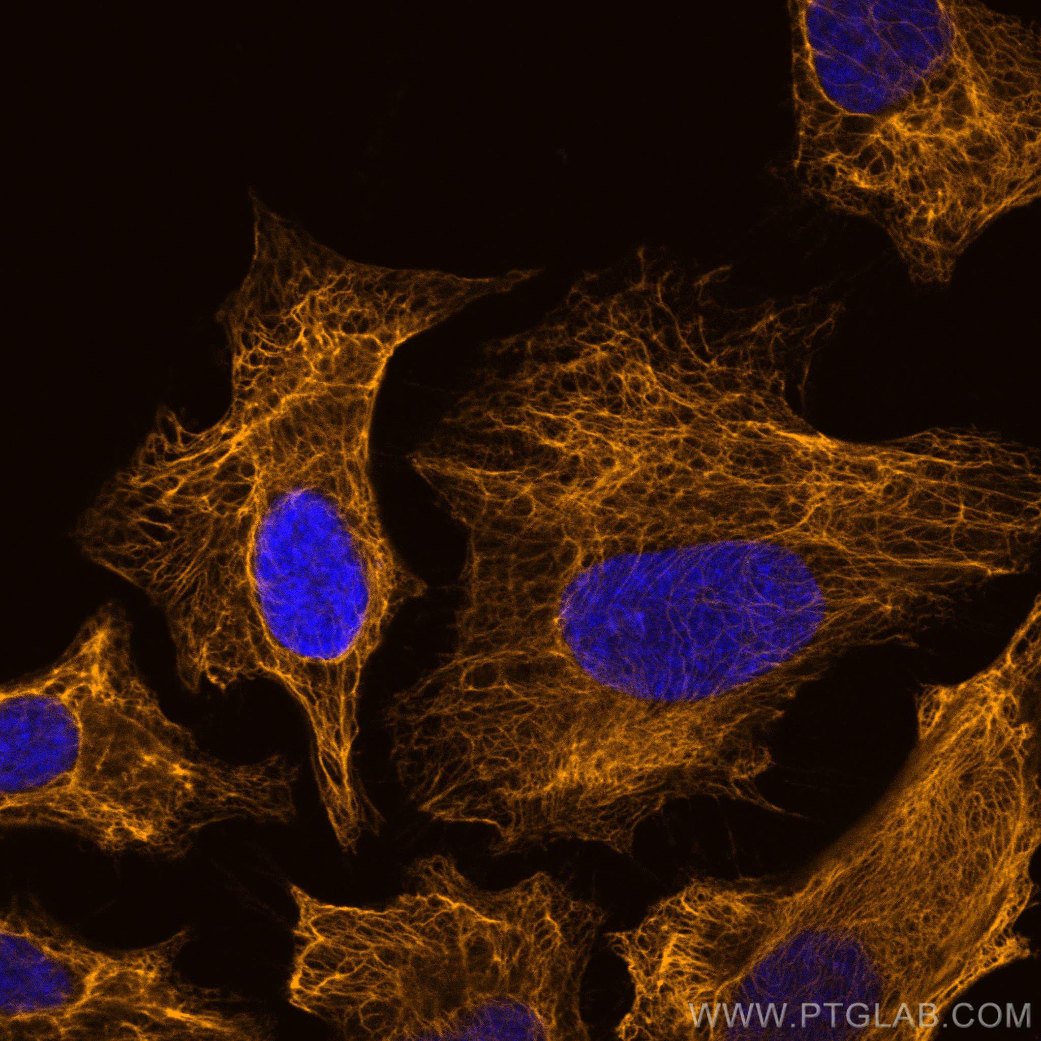 Immunofluorescence (IF) / fluorescent staining of HeLa cells using CoraLite®555-conjugated Cytokeratin 17-Specific Po (CL555-17516)